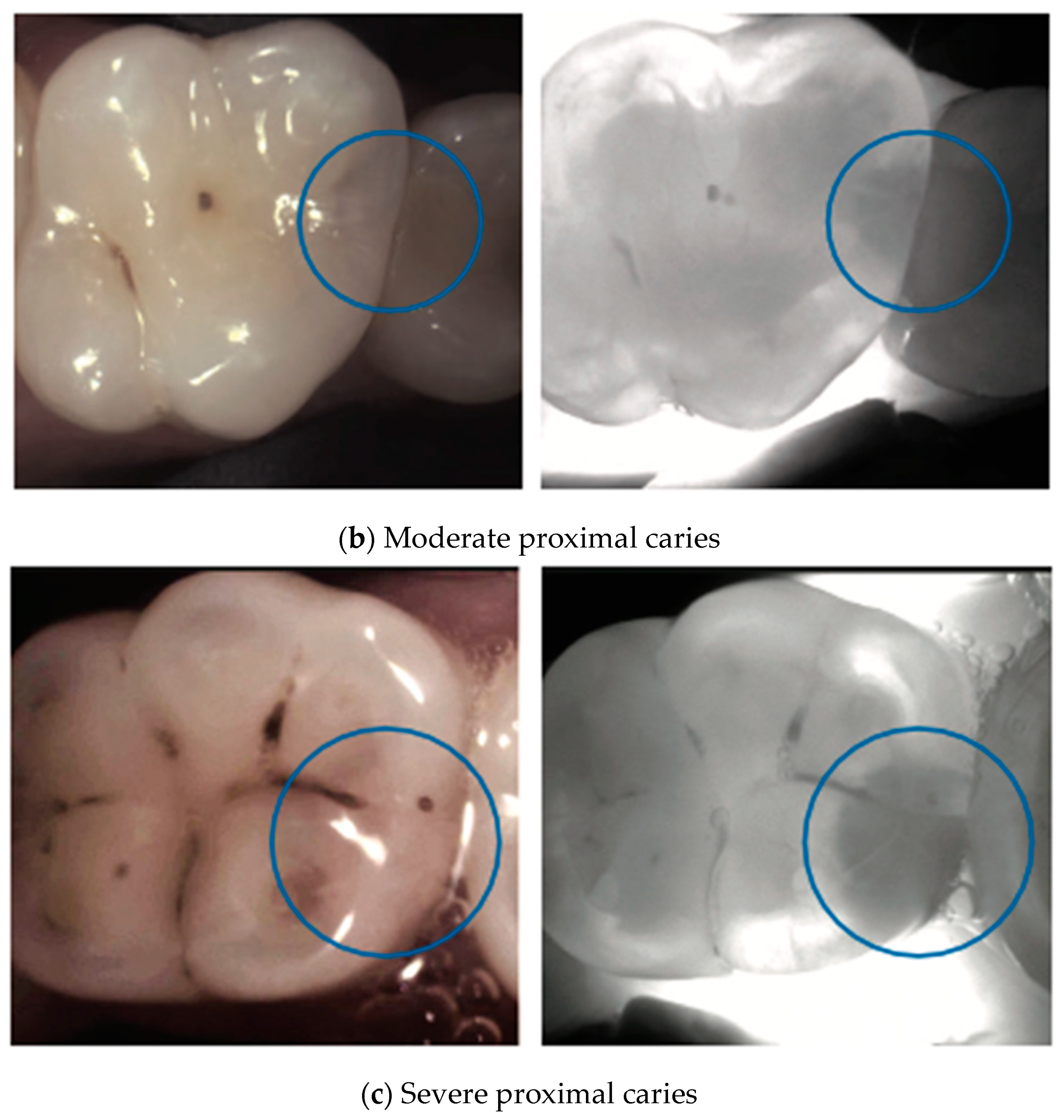 Diagnostics 14 01154 g003b
