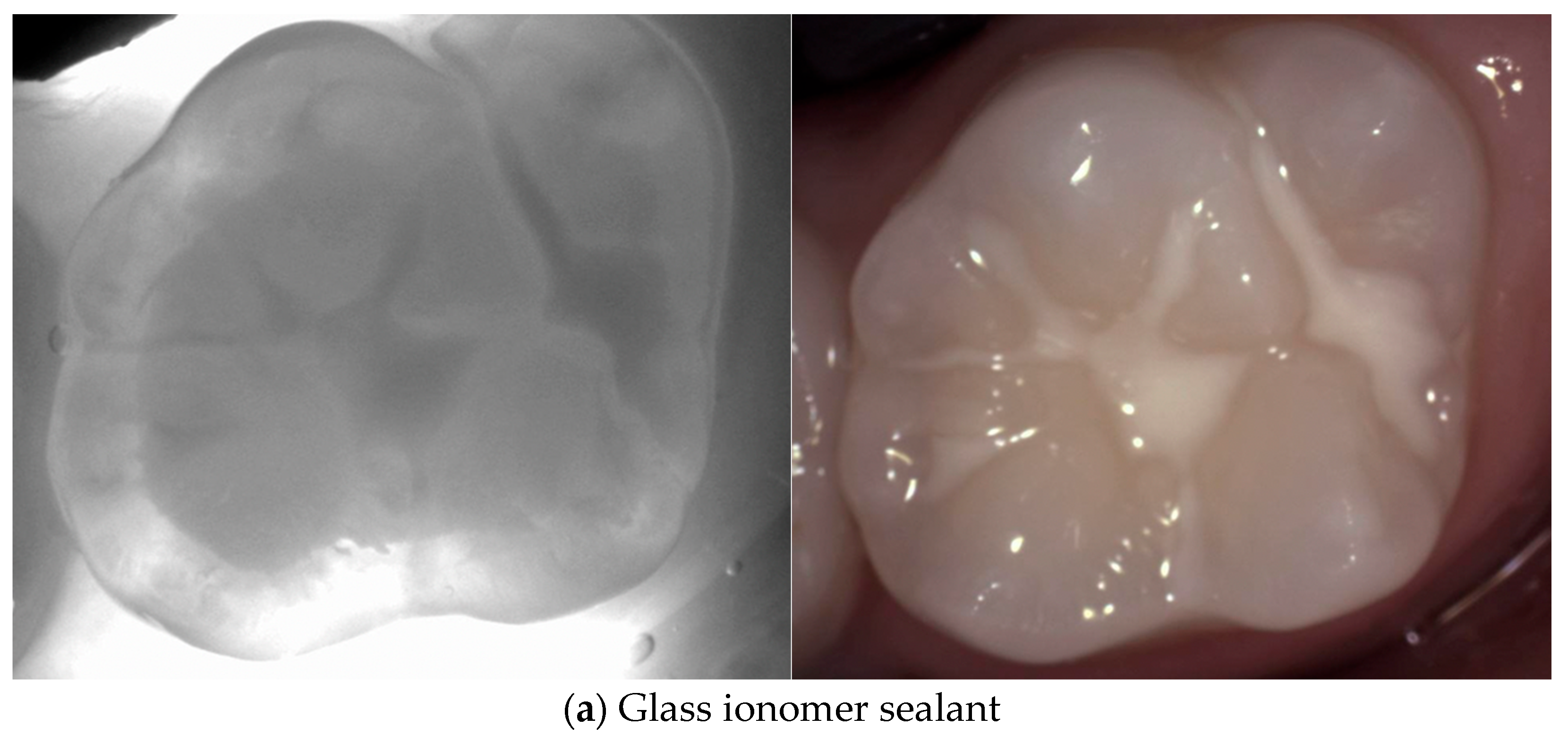 Diagnostics 14 01154 g006a