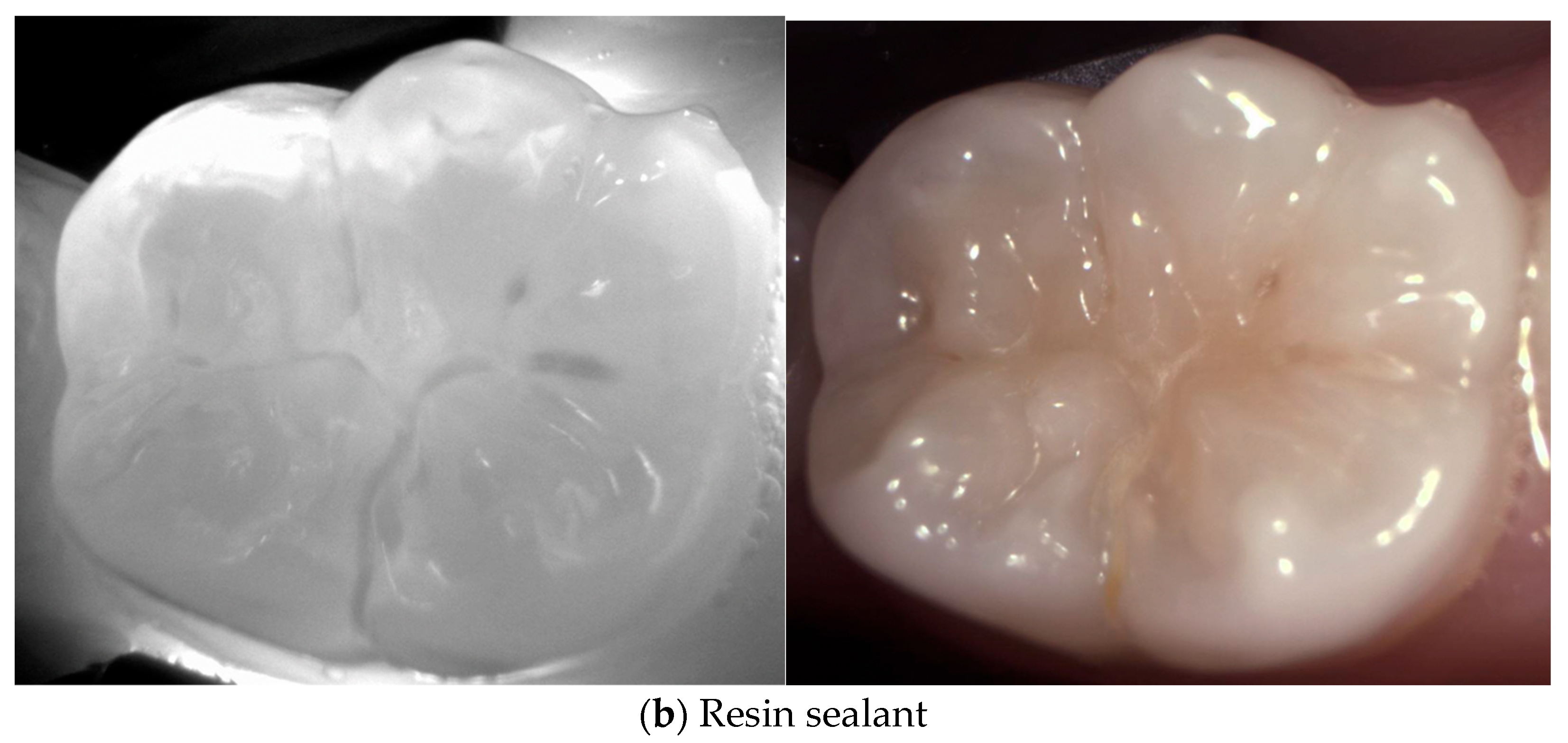 Diagnostics 14 01154 g006b
