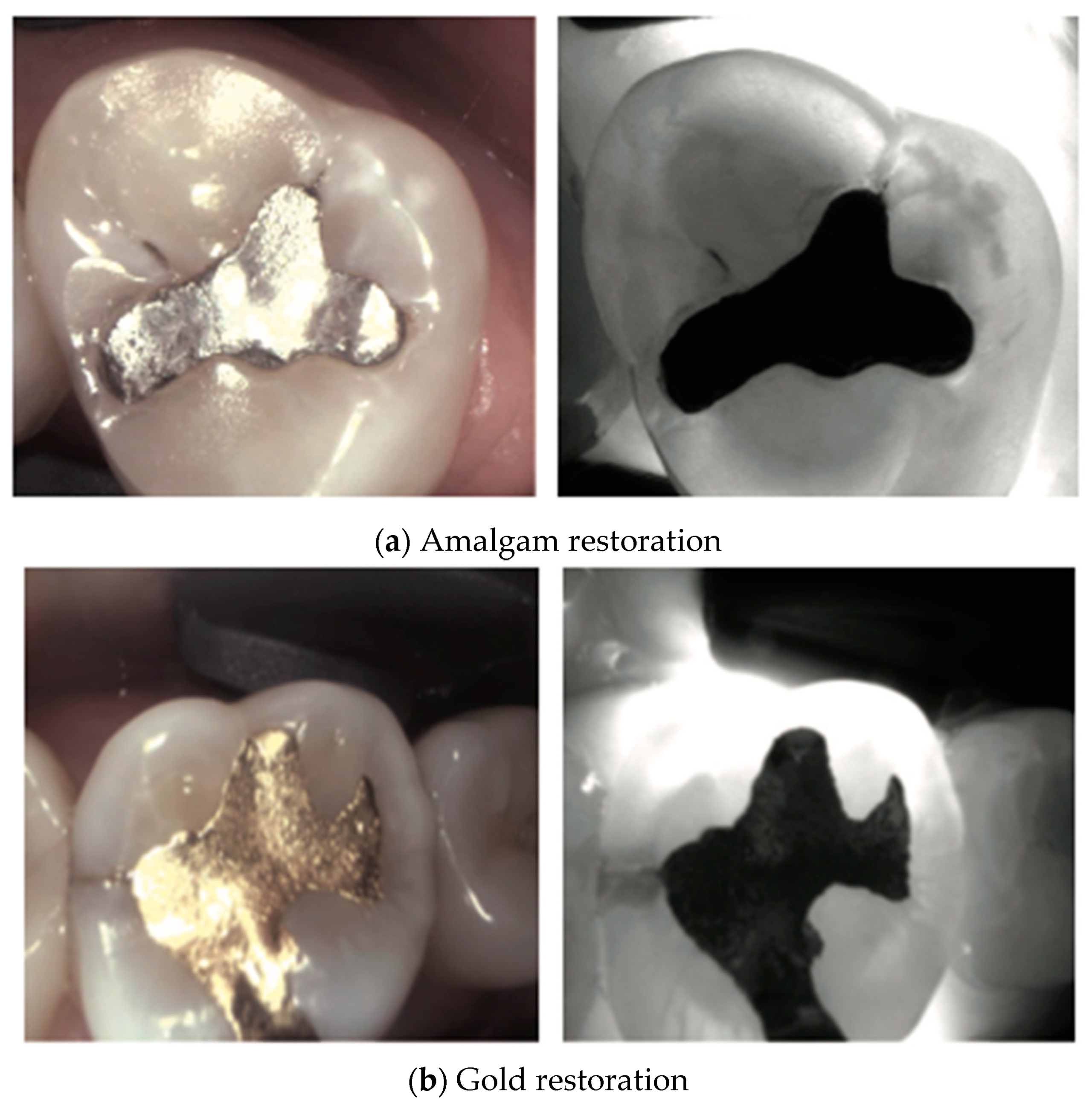 Diagnostics 14 01154 g007a