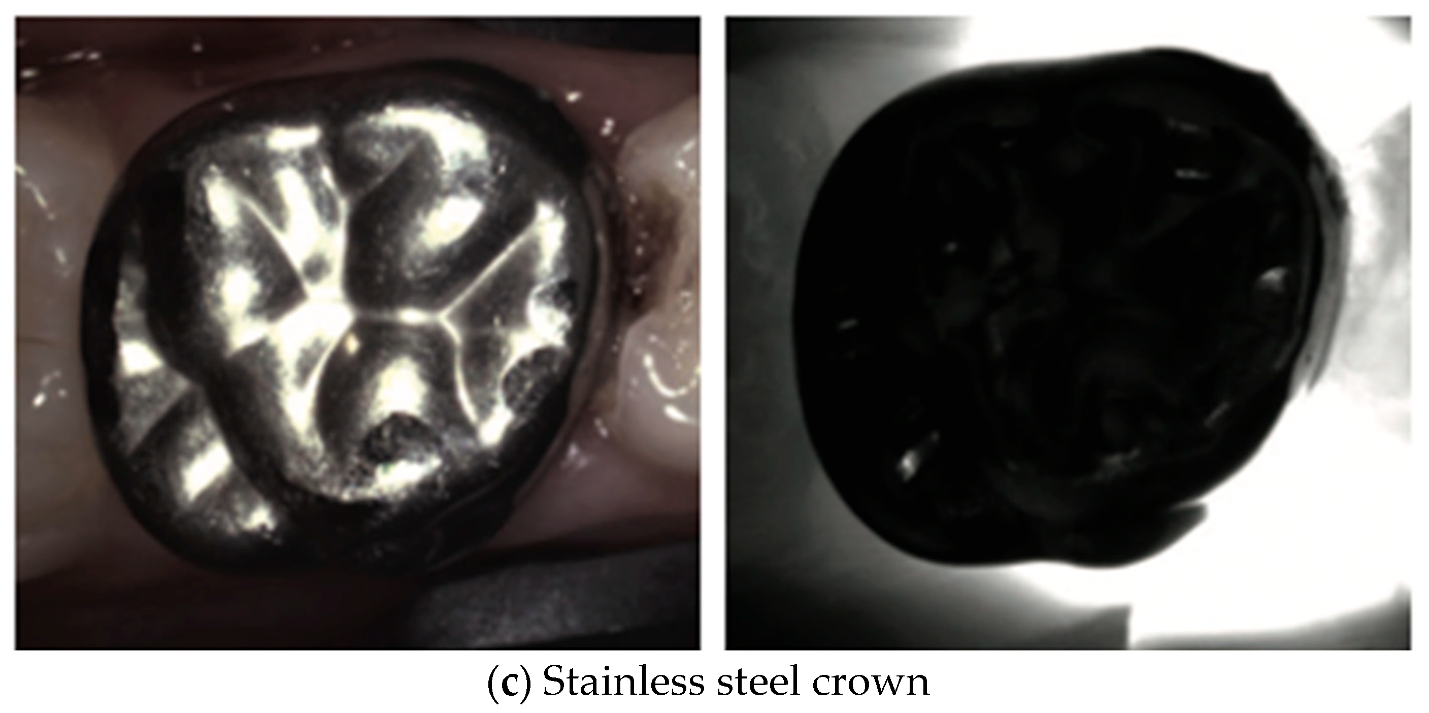 Diagnostics 14 01154 g007b