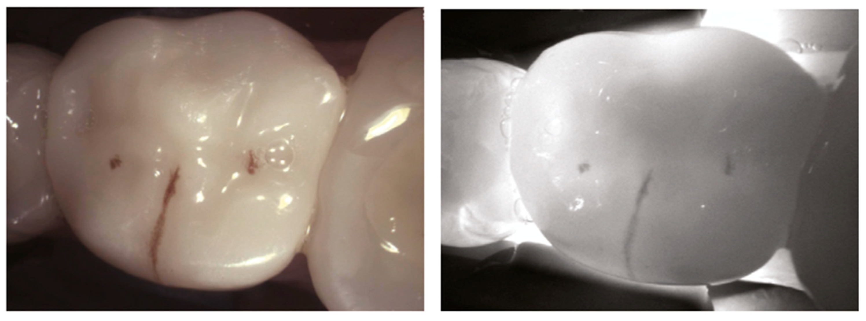 Diagnostics 14 01154 g008