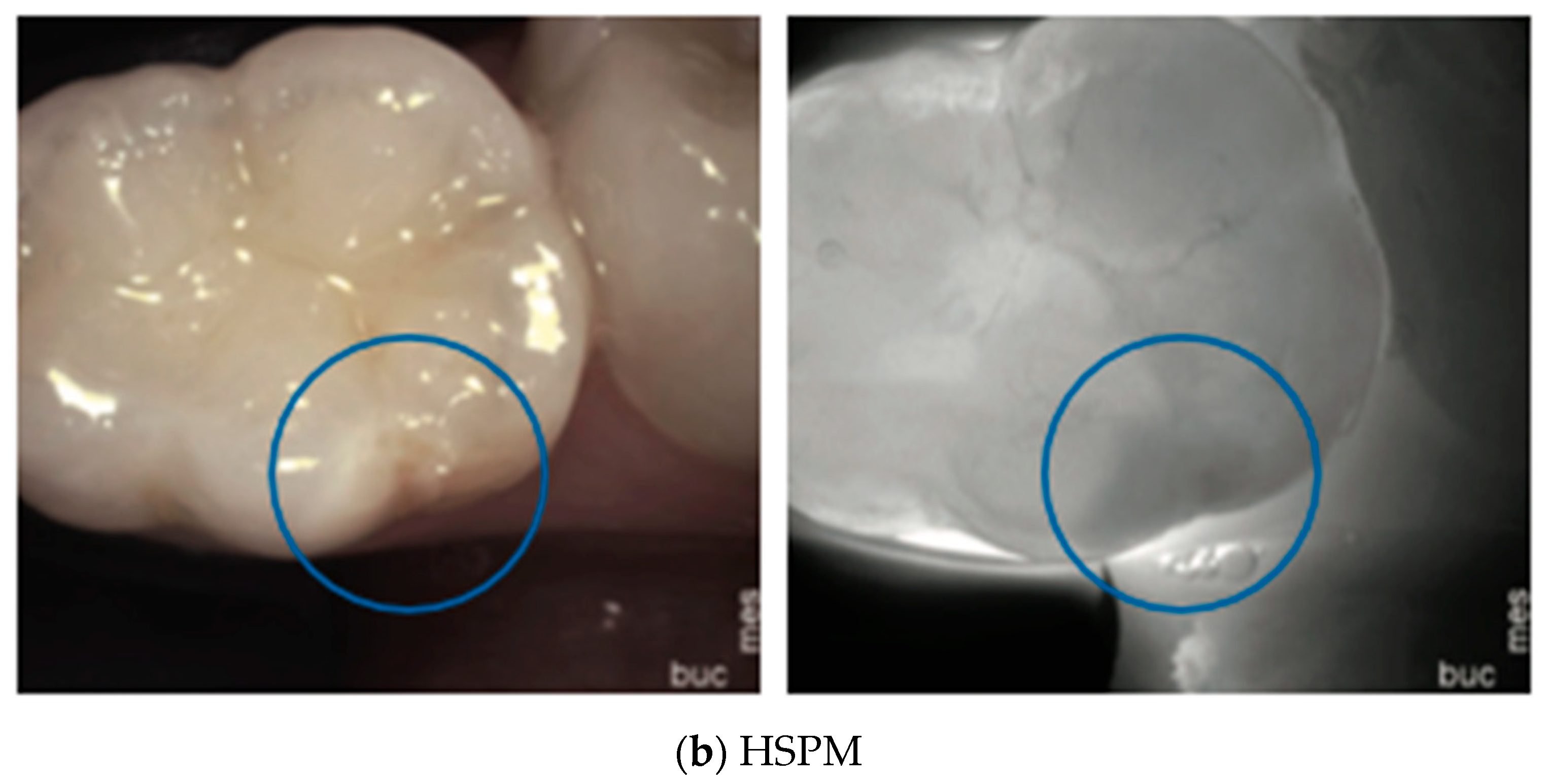 Diagnostics 14 01154 g009b