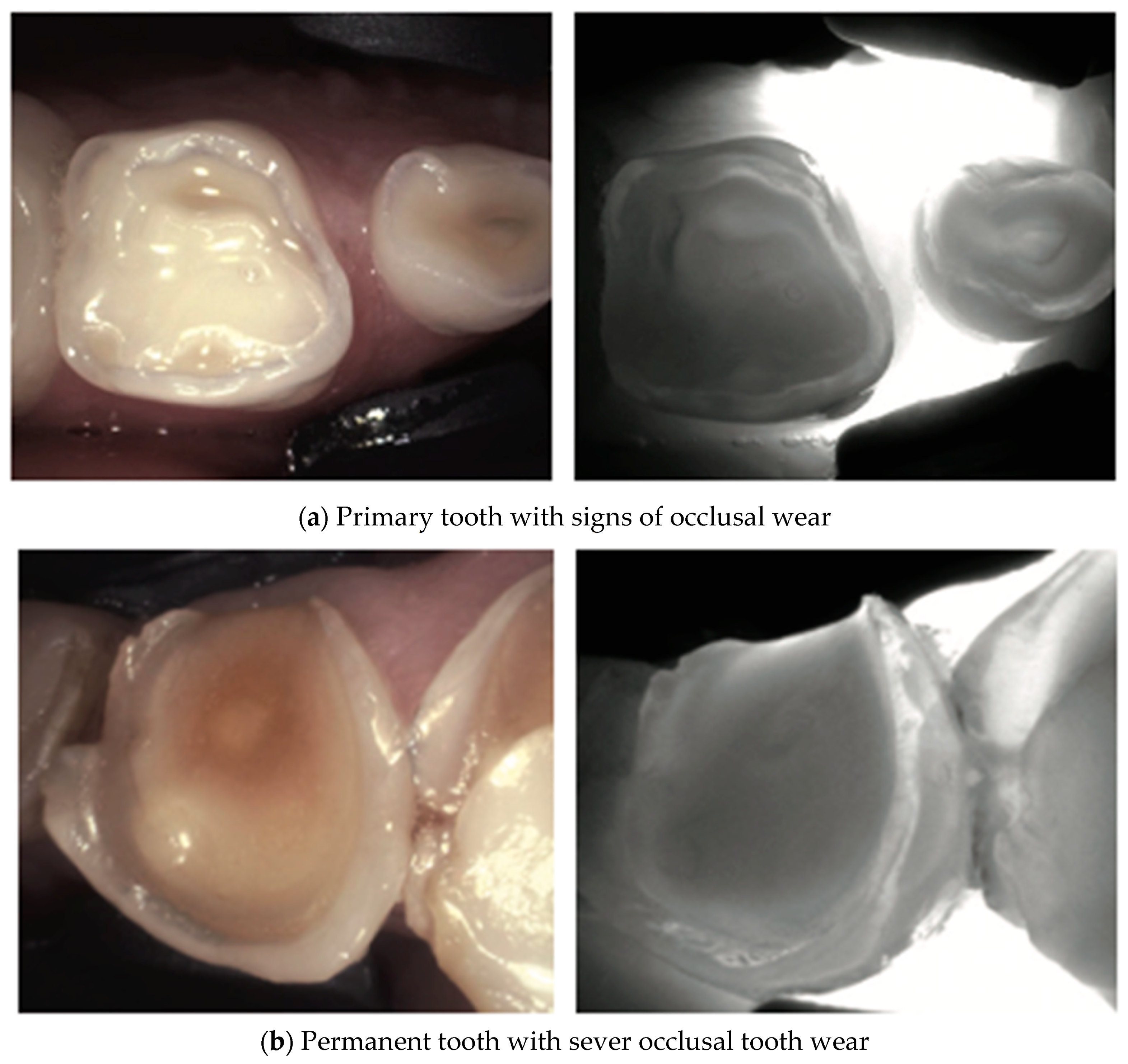 Diagnostics 14 01154 g012