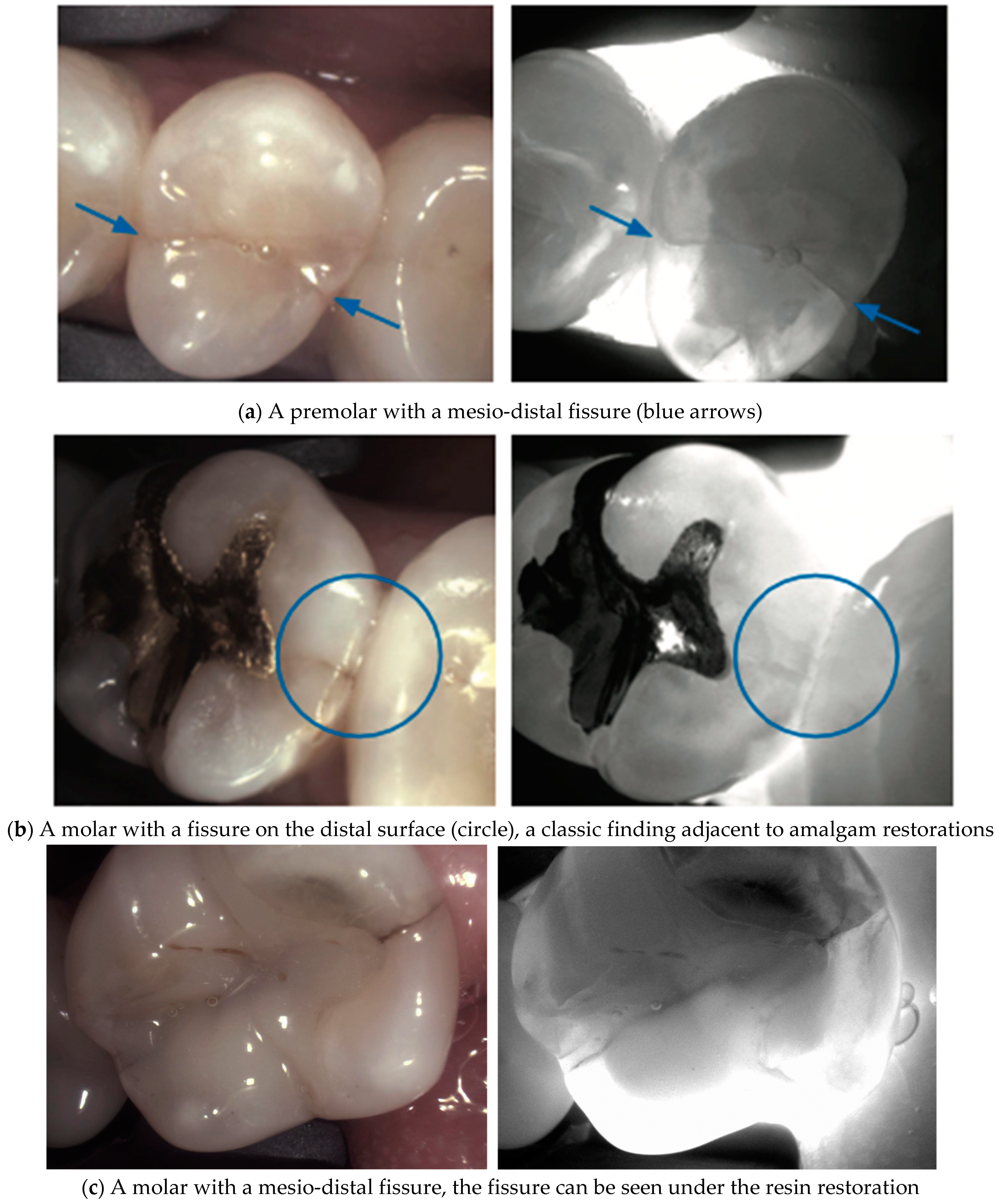 Diagnostics 14 01154 g013