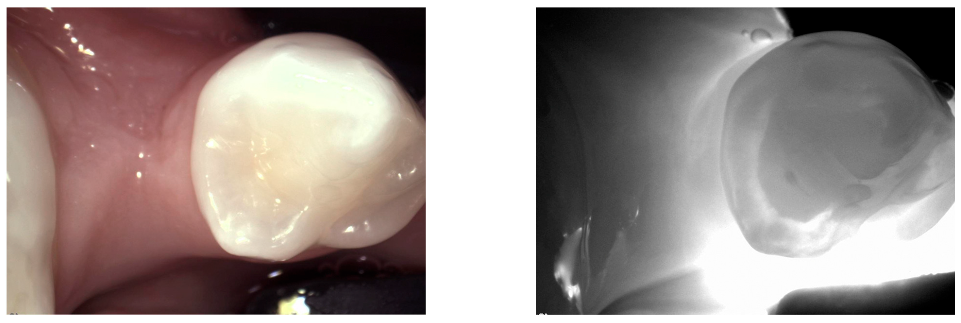 Diagnostics 14 01154 g014