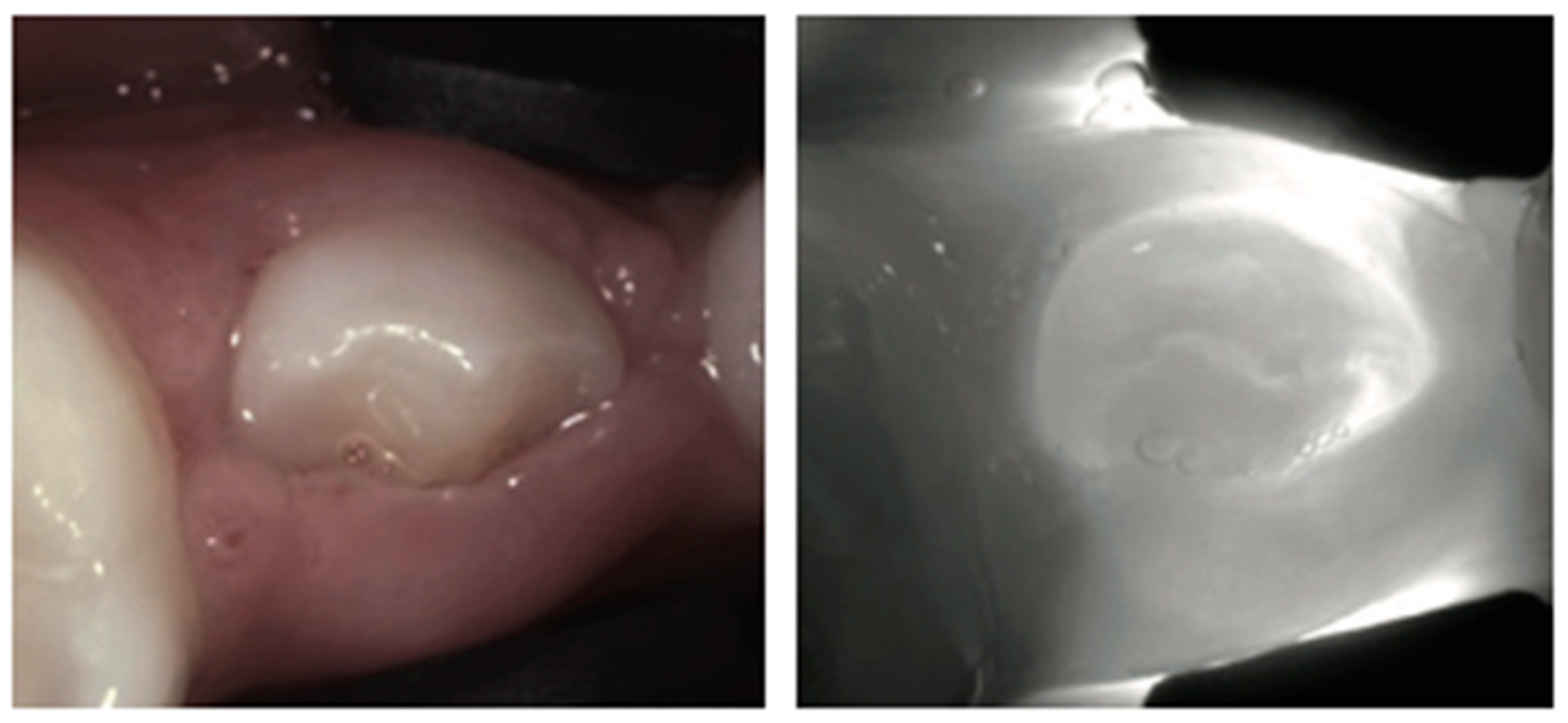 Diagnostics 14 01154 g016