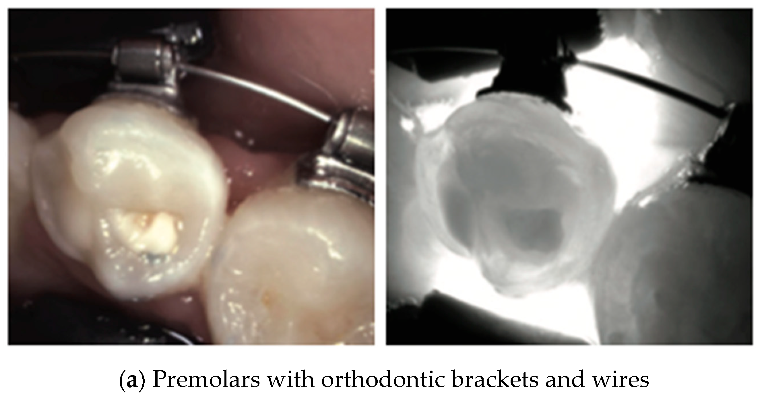 Diagnostics 14 01154 g018a