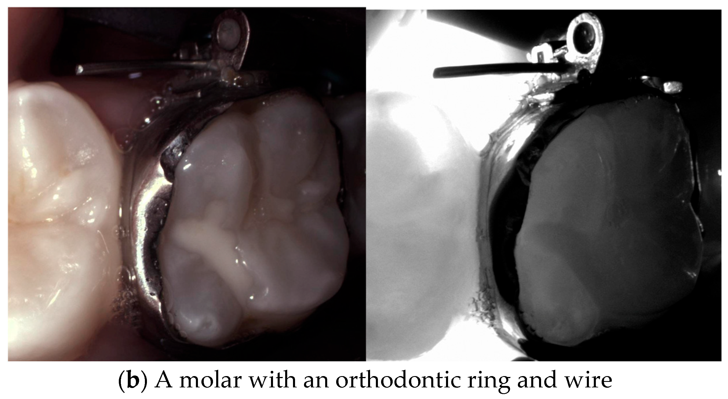 Diagnostics 14 01154 g018b