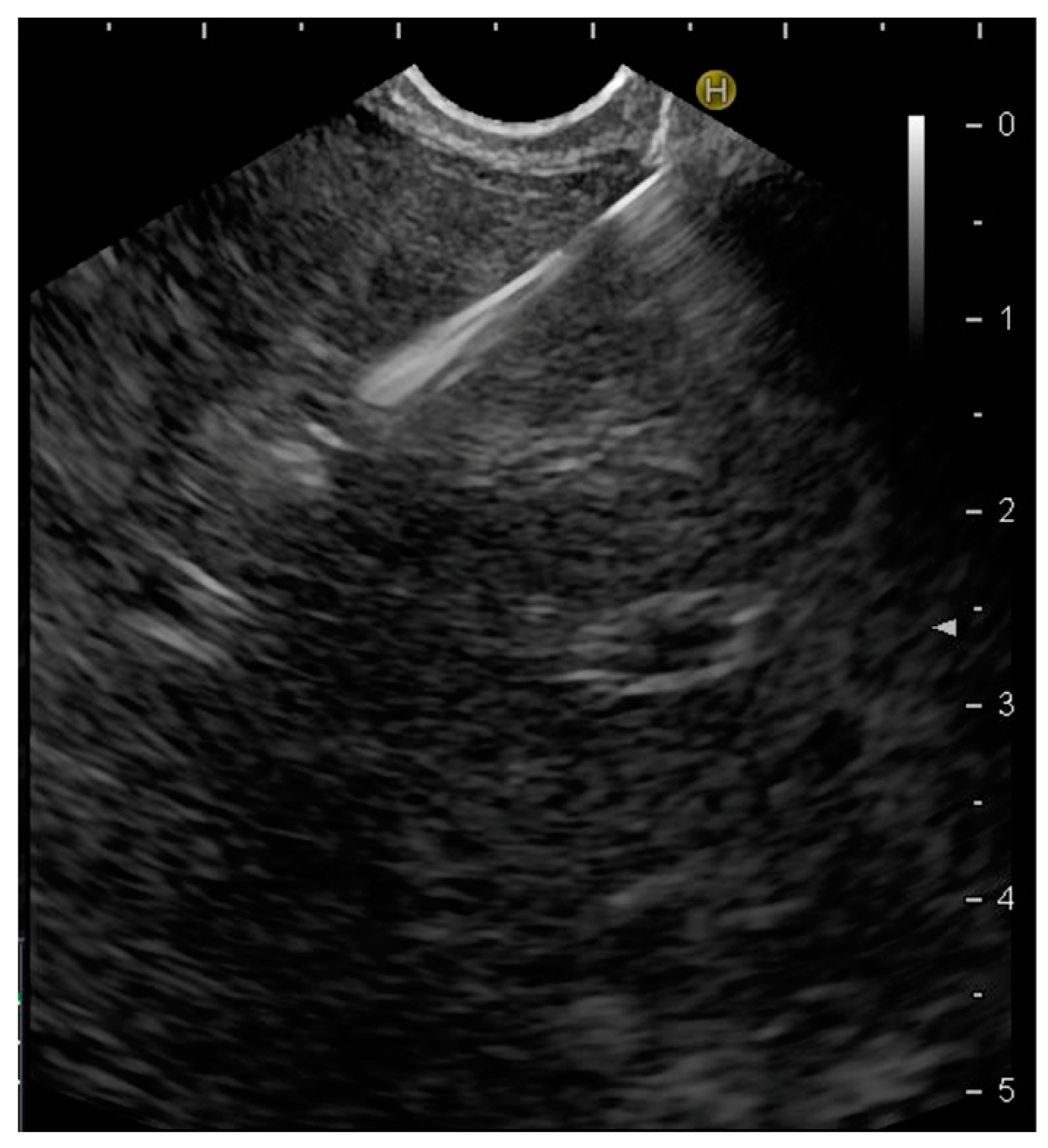 Diagnostics 14 01155 g001