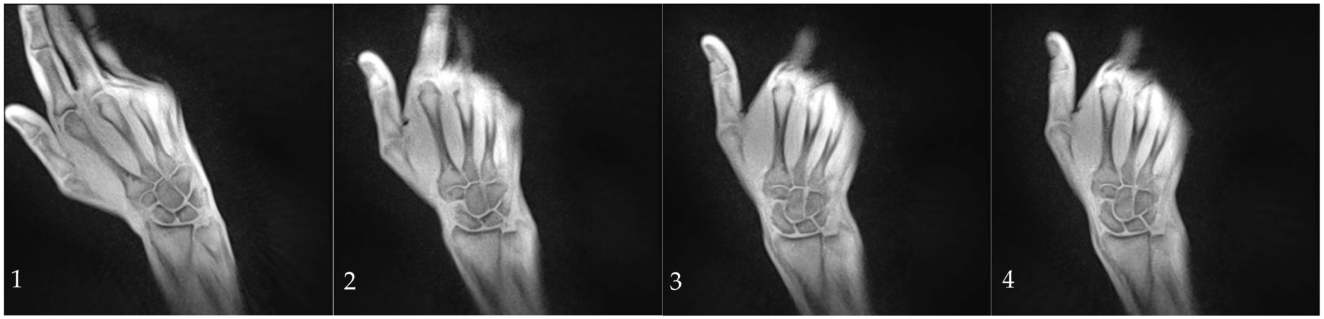 Diagnostics 14 01177 g001