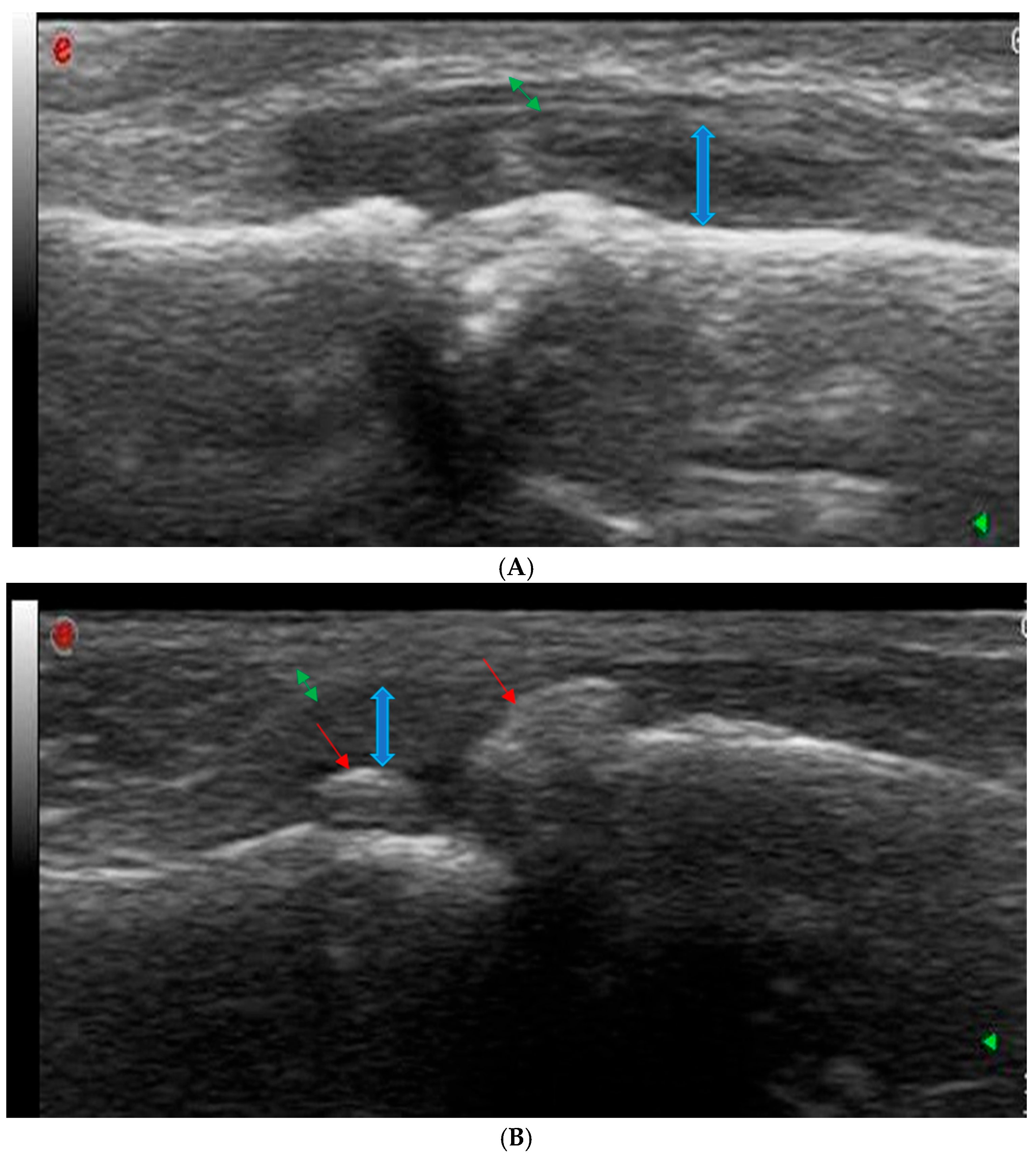 Diagnostics 14 01181 g002