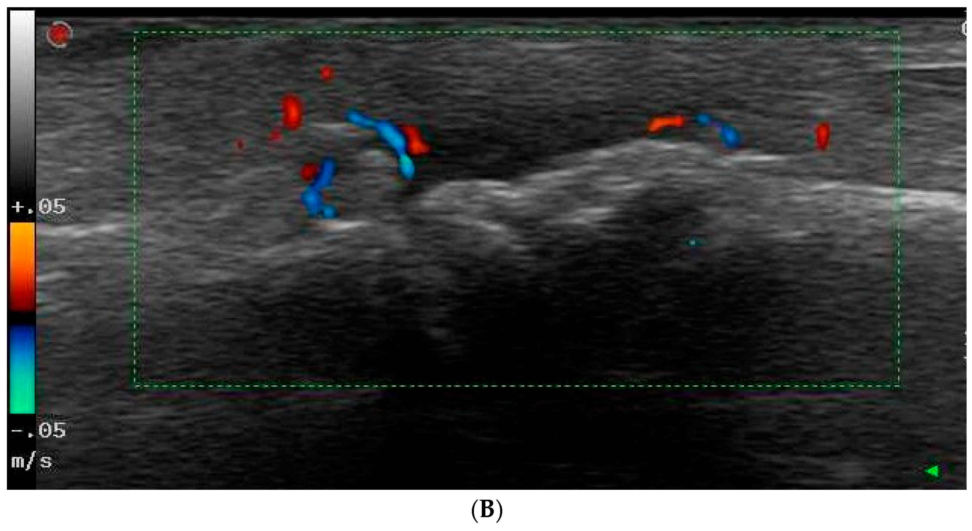 Diagnostics 14 01181 g003b