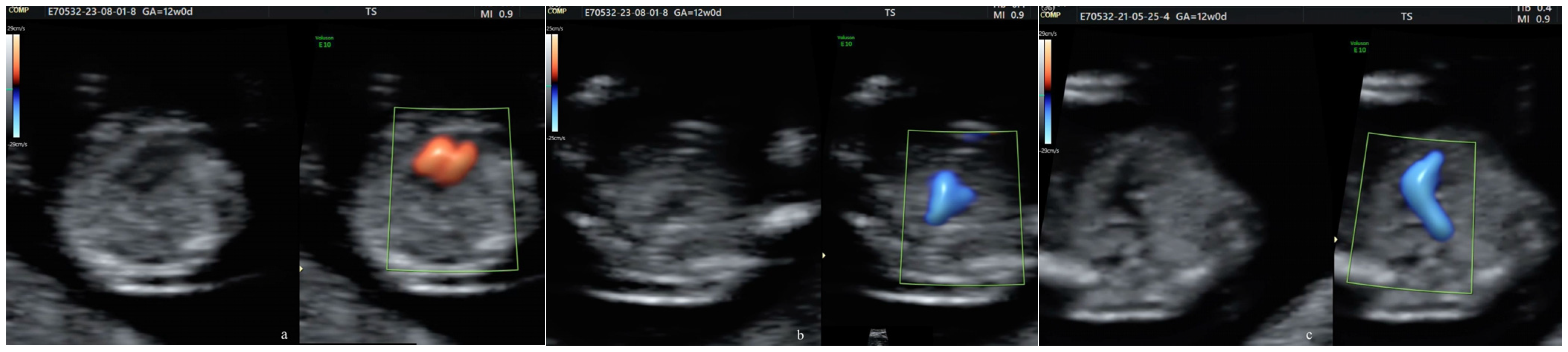 Diagnostics 14 01185 g001