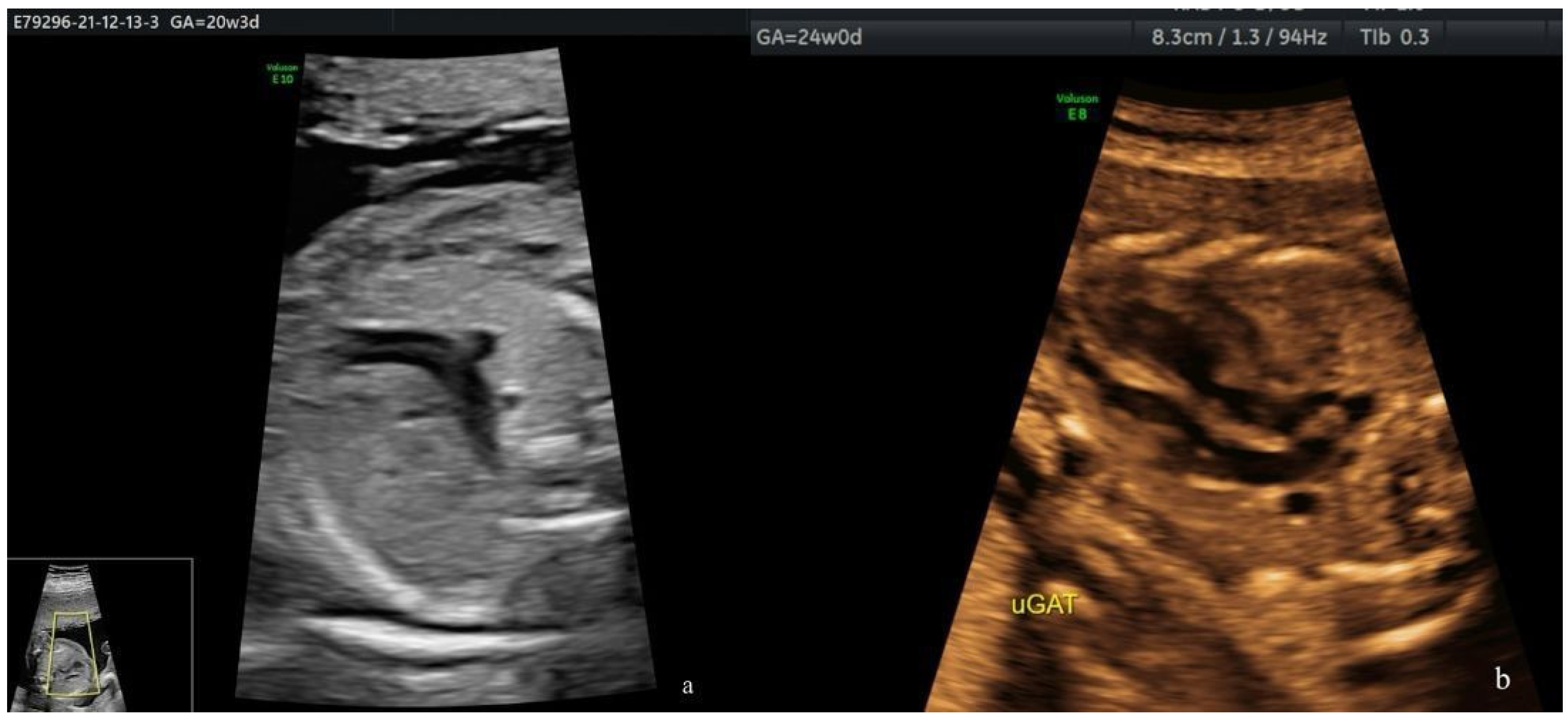 Diagnostics 14 01185 g002