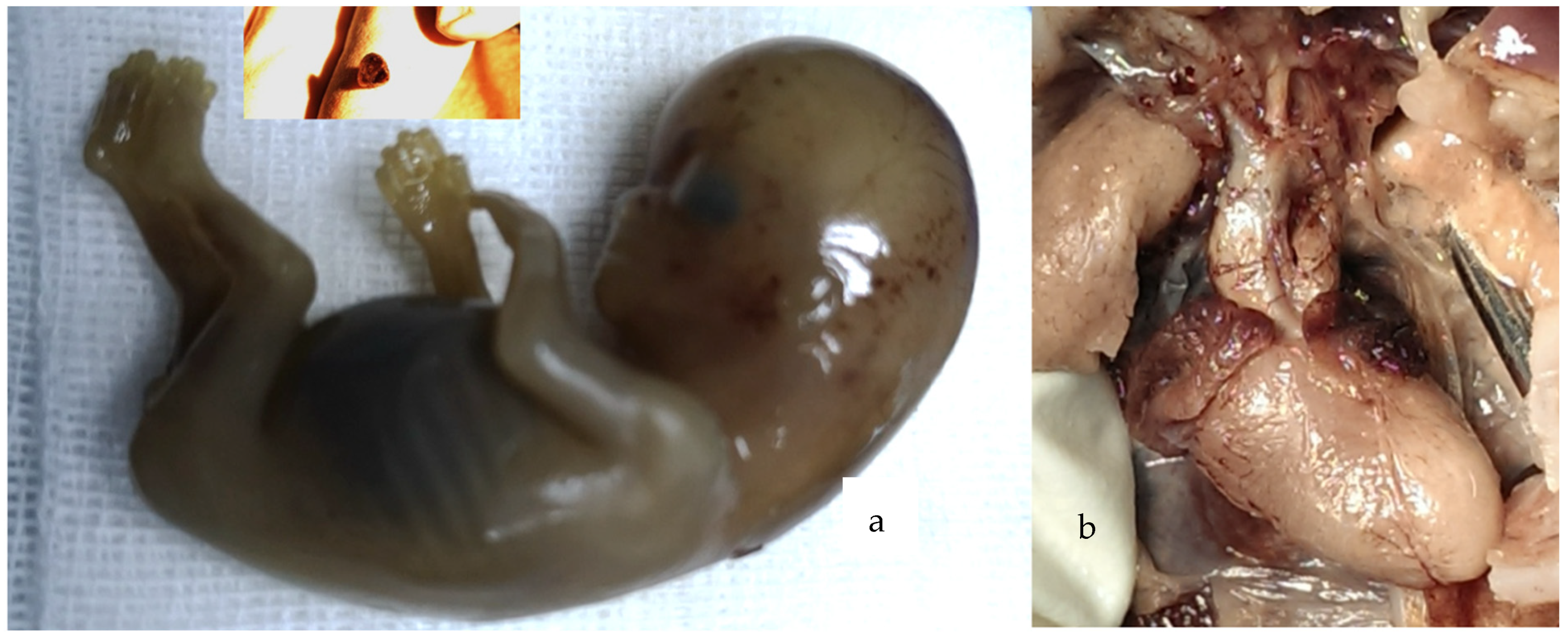 Diagnostics 14 01185 g005