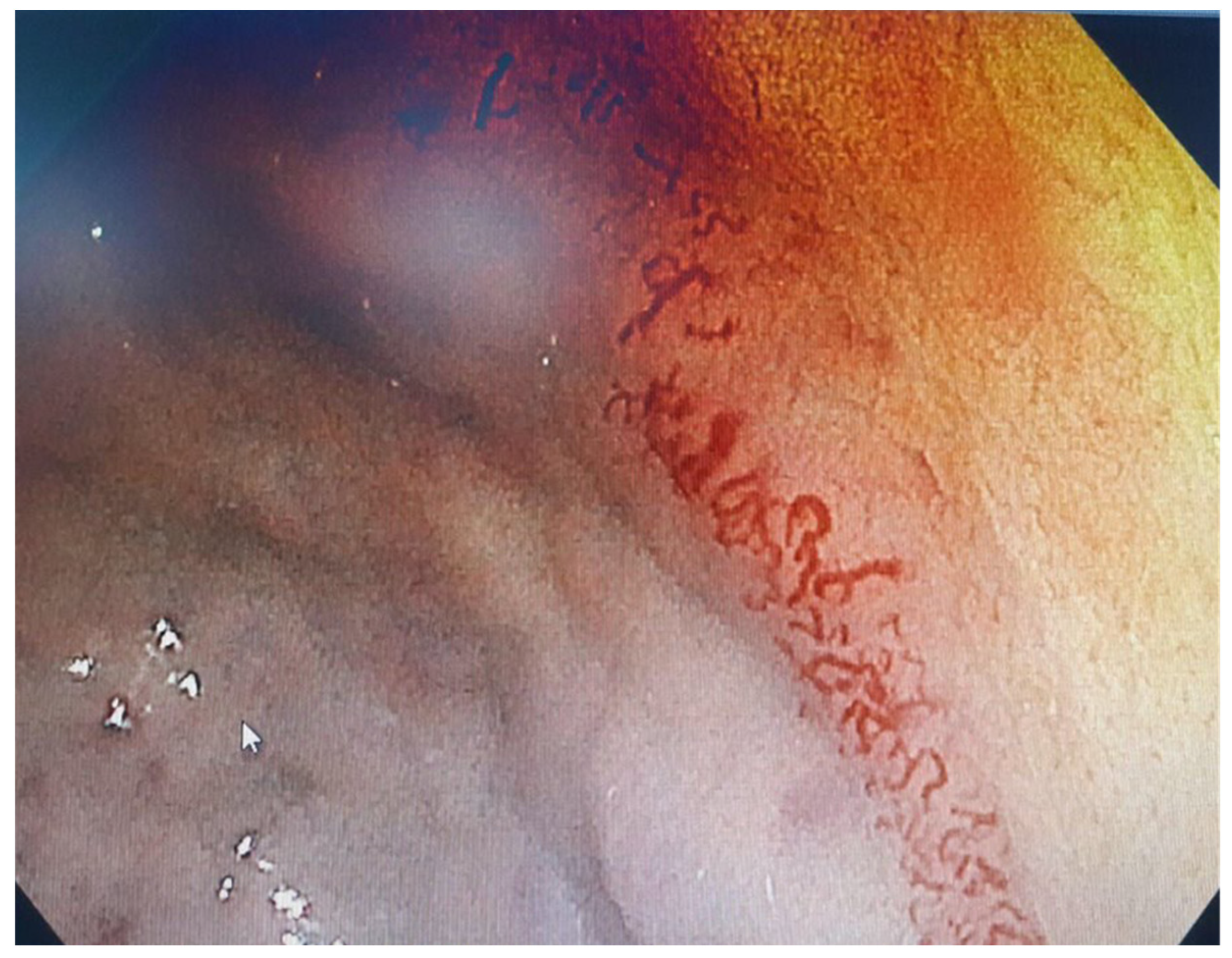 Diagnostics 14 01187 g001