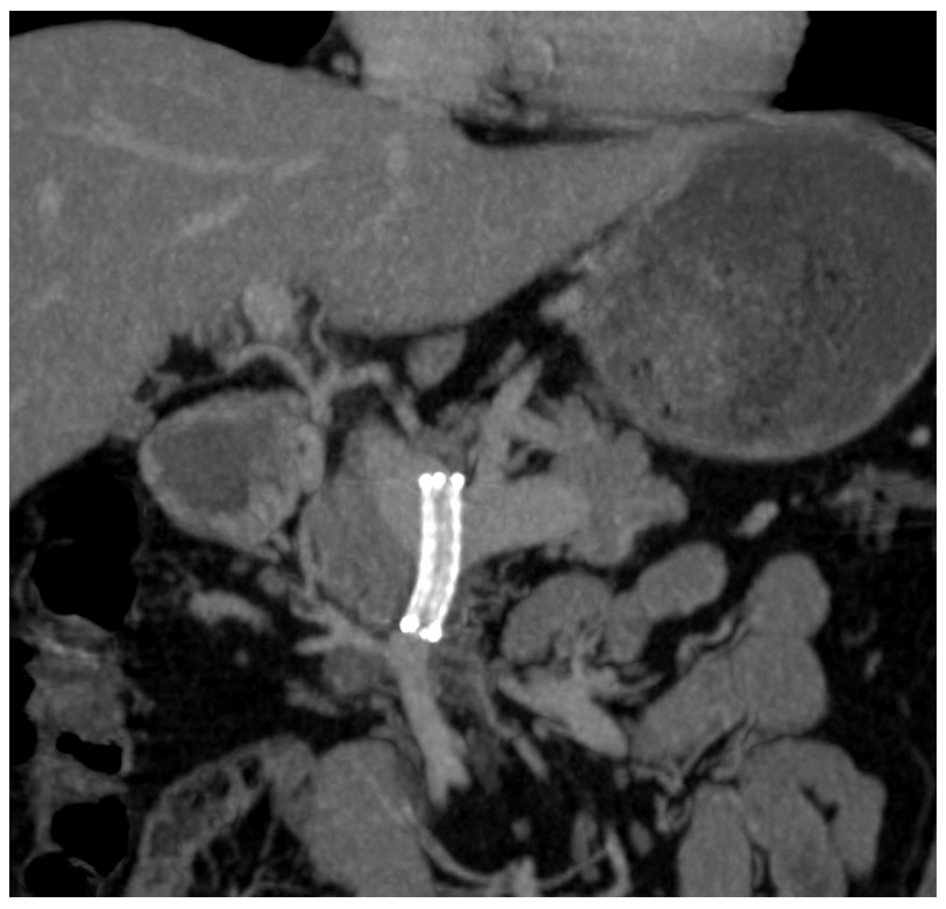 Diagnostics 14 01187 g006