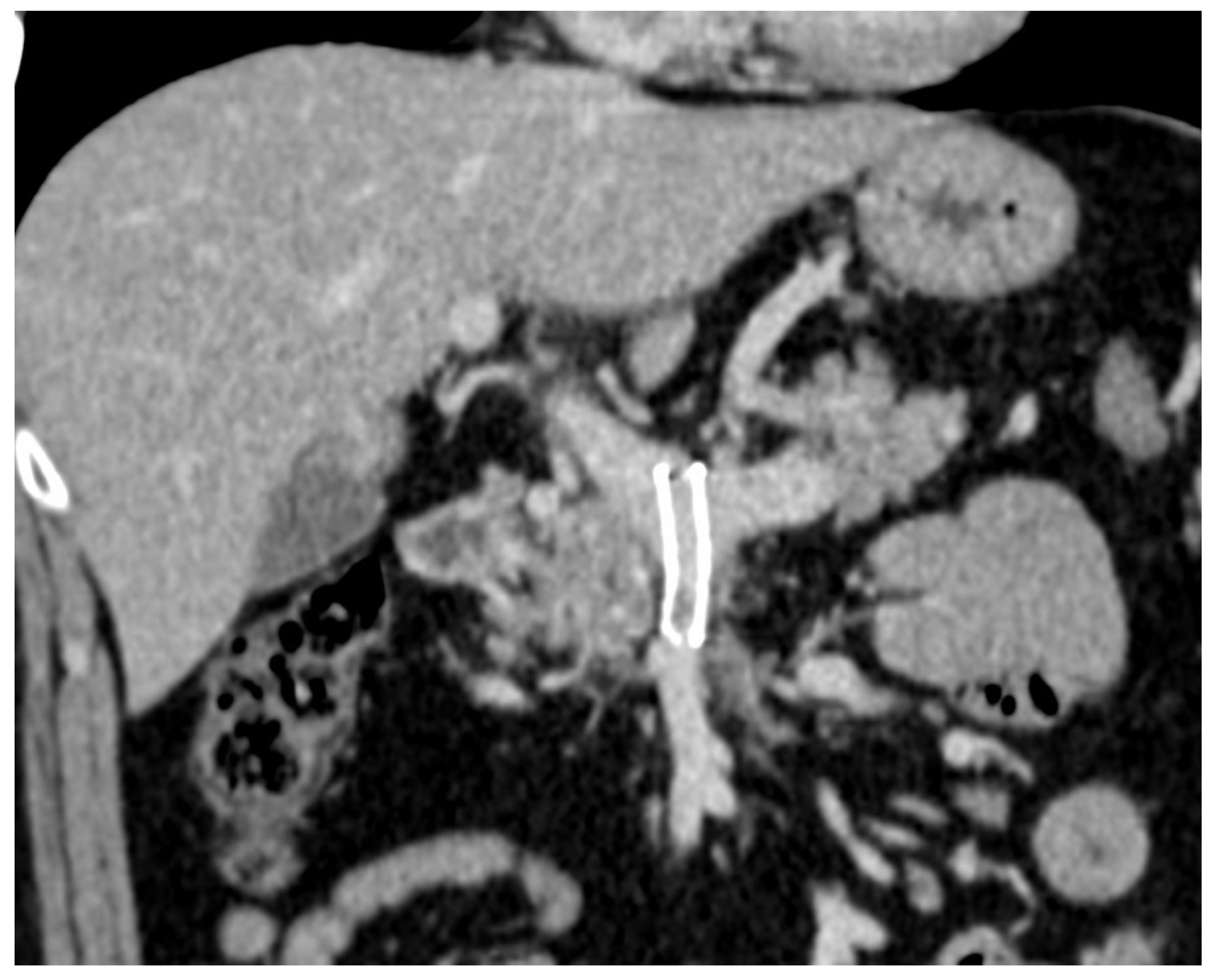 Diagnostics 14 01187 g007