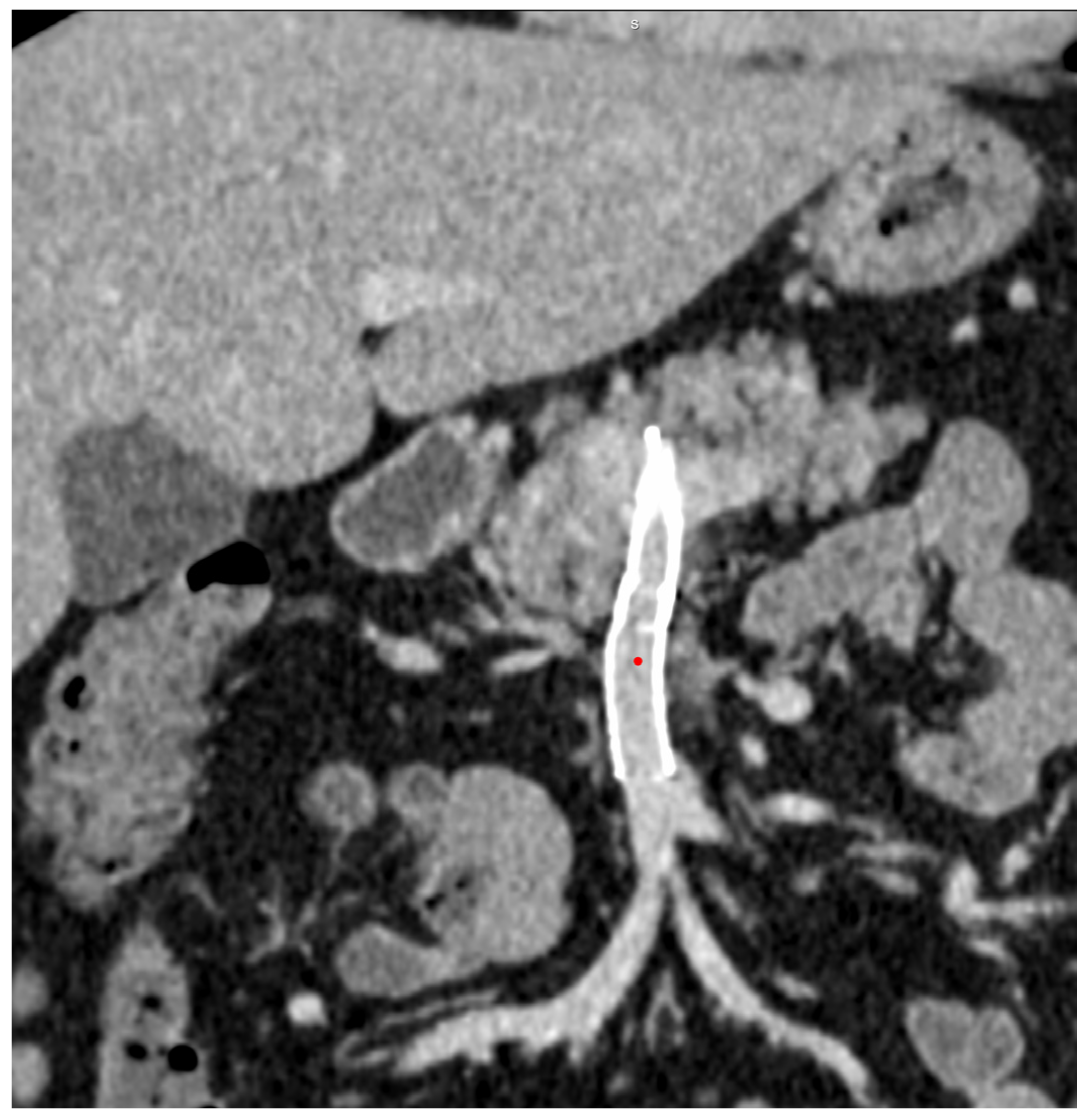 Diagnostics 14 01187 g009