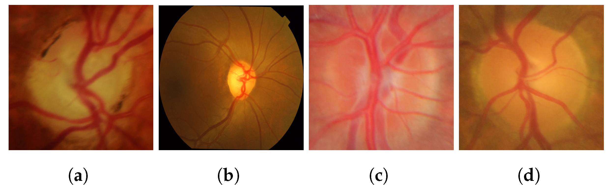 Diagnostics 14 01191 g002