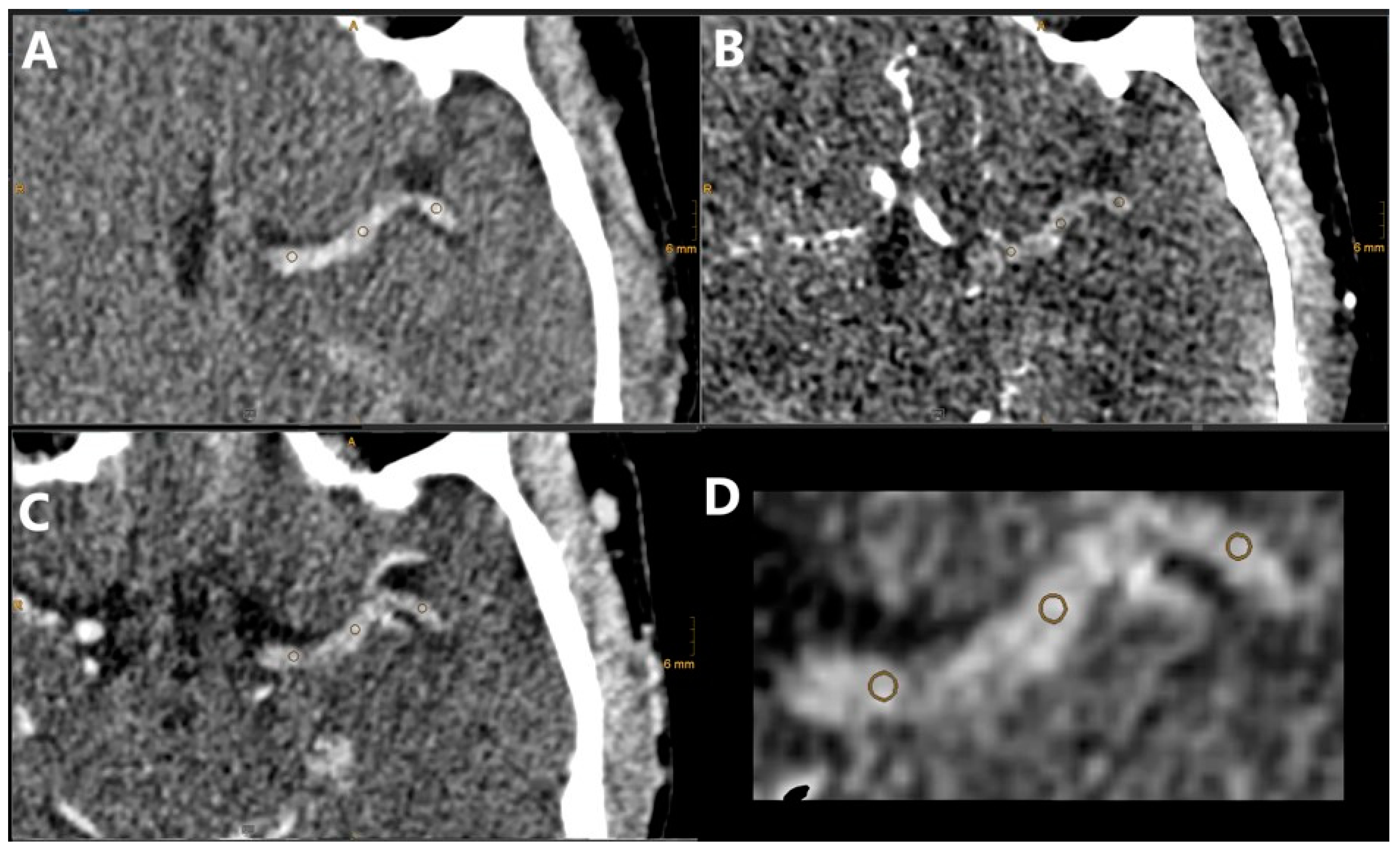 Diagnostics 14 01197 g002