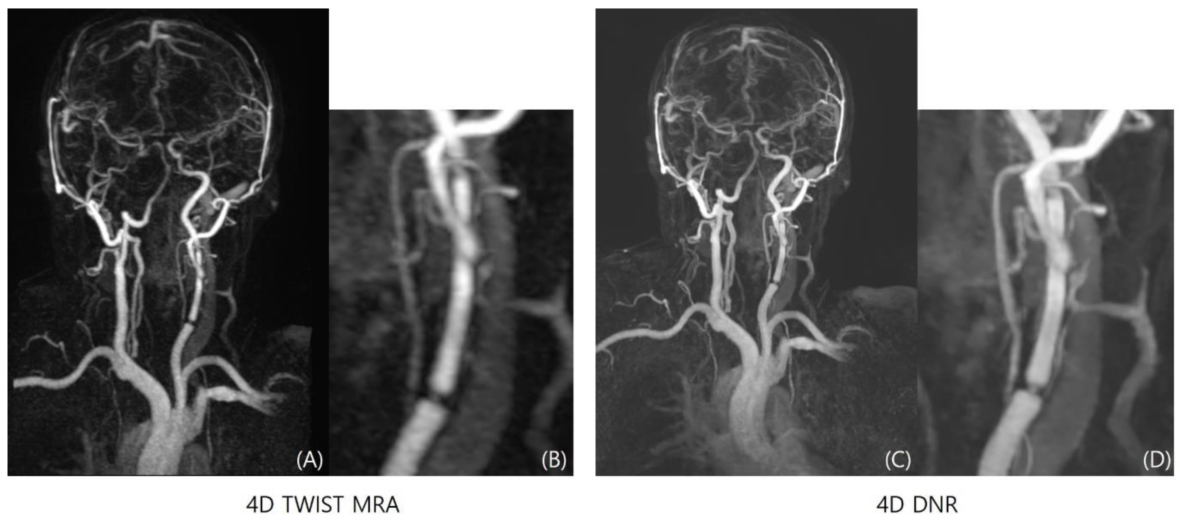 Diagnostics 14 01199 g004