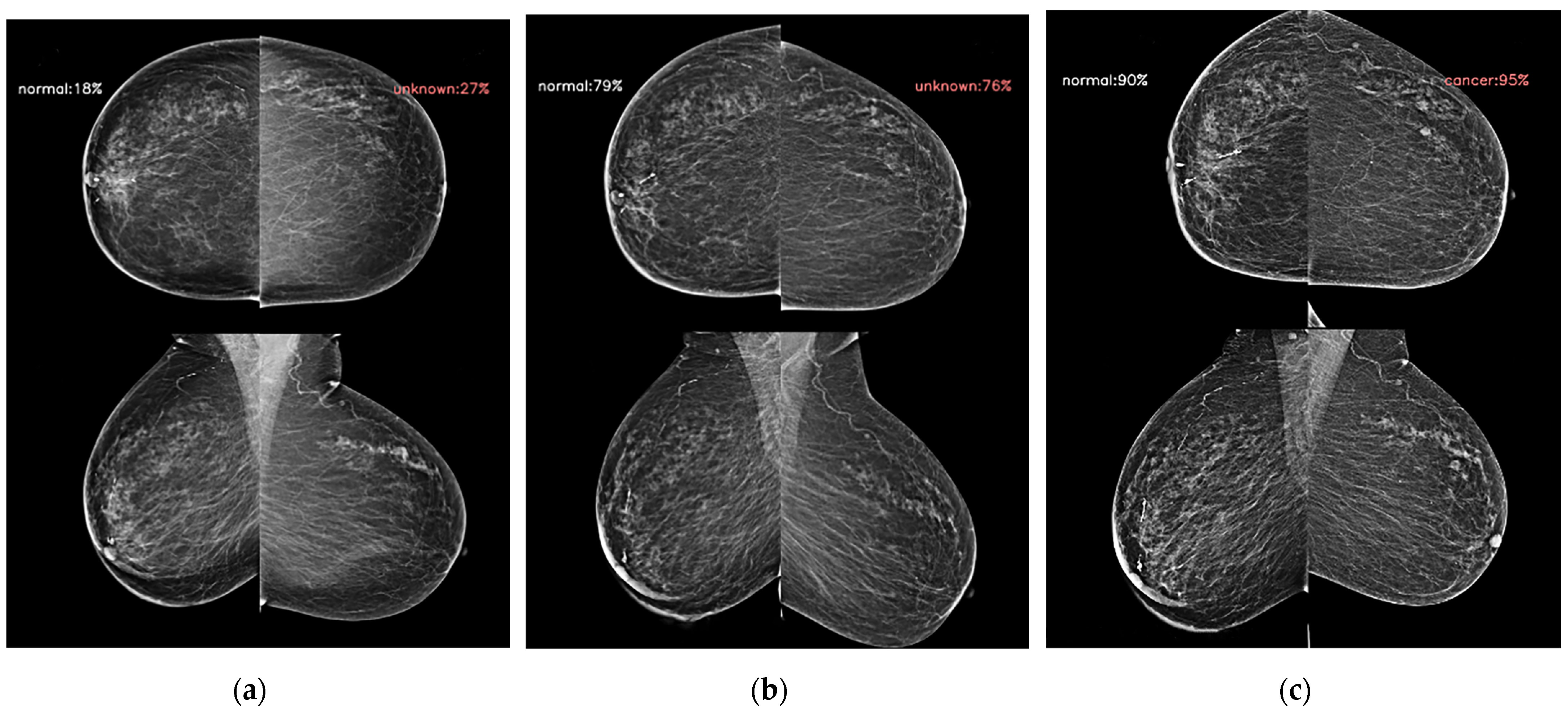 Diagnostics 14 01212 g002