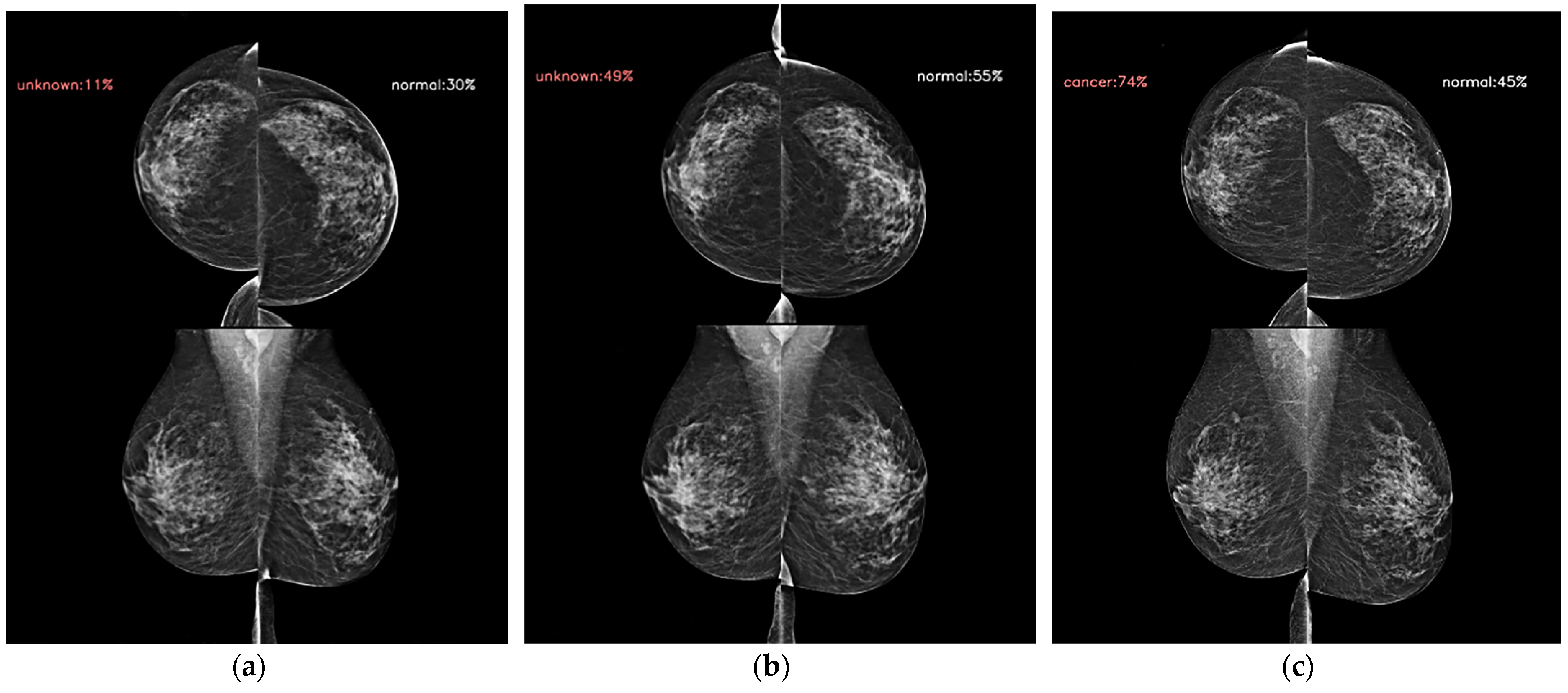 Diagnostics 14 01212 g003