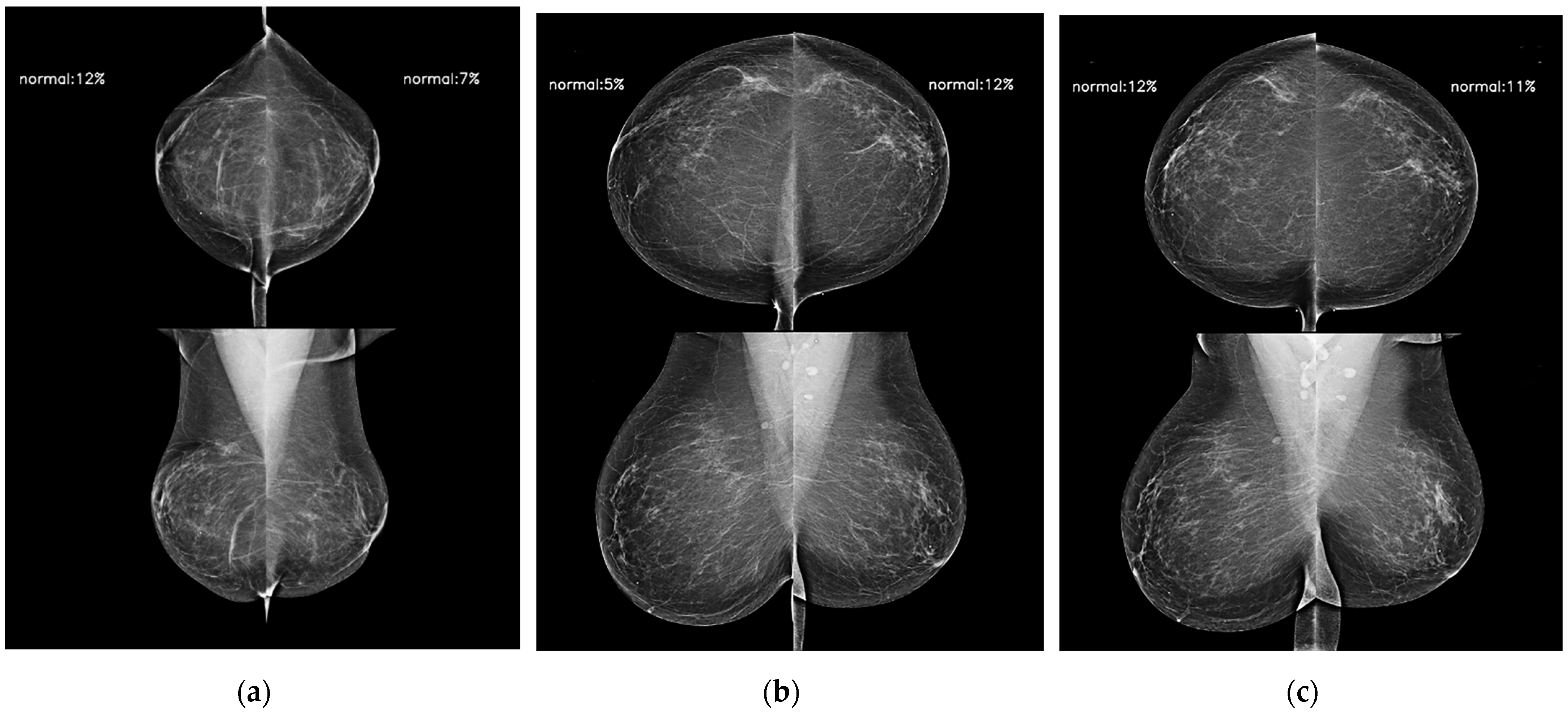Diagnostics 14 01212 g005