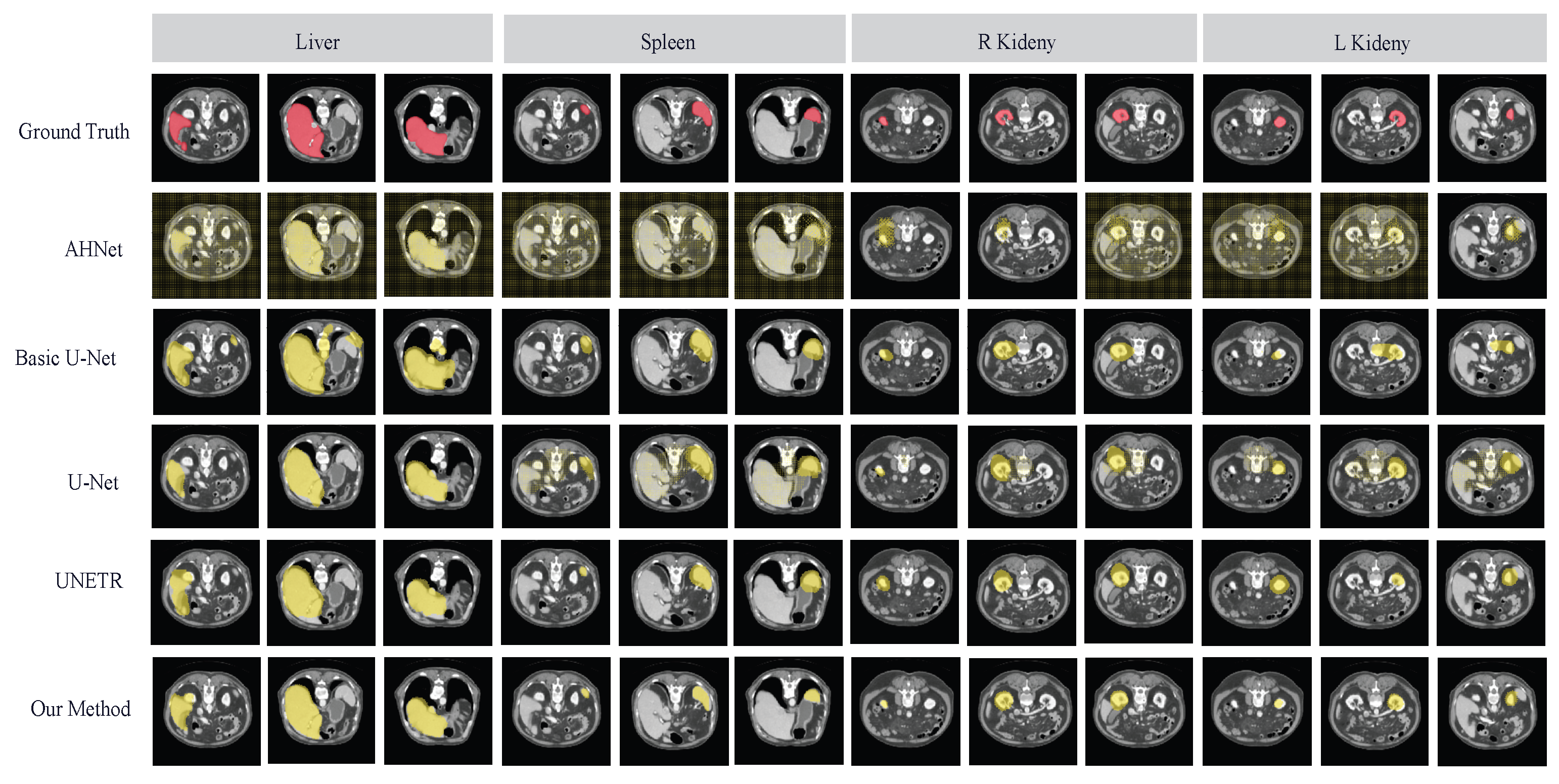 Diagnostics 14 01213 g011