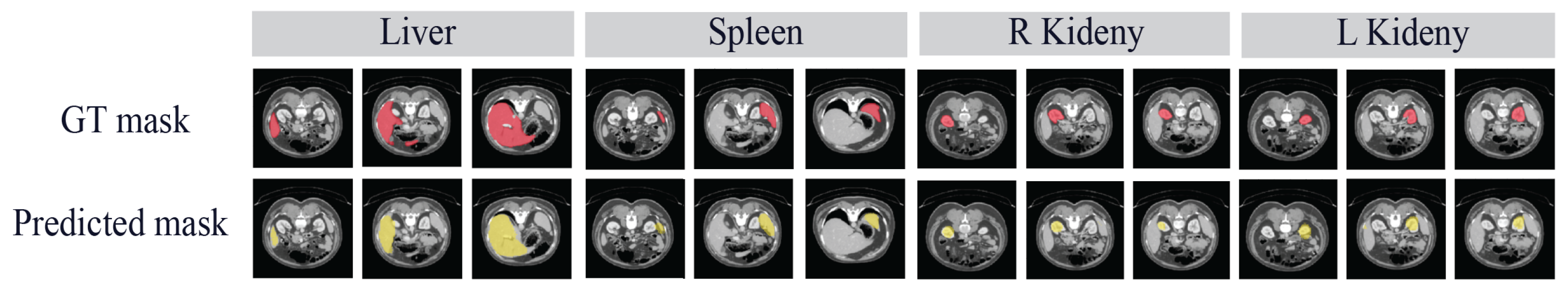 Diagnostics 14 01213 g012