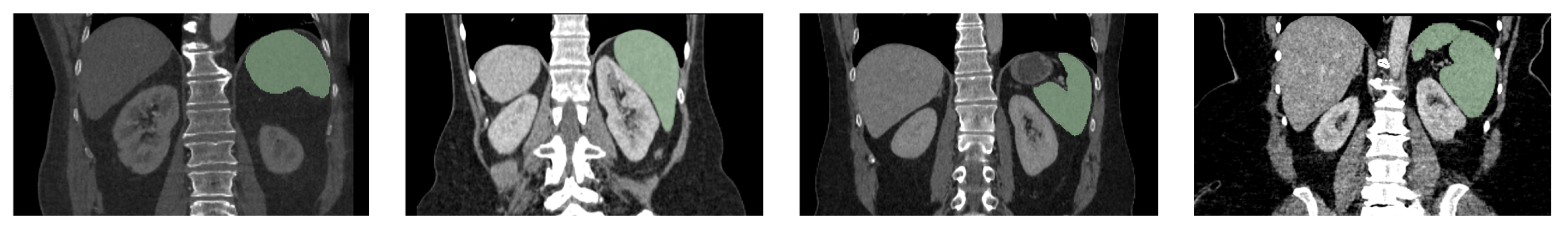Diagnostics 14 01213 g013