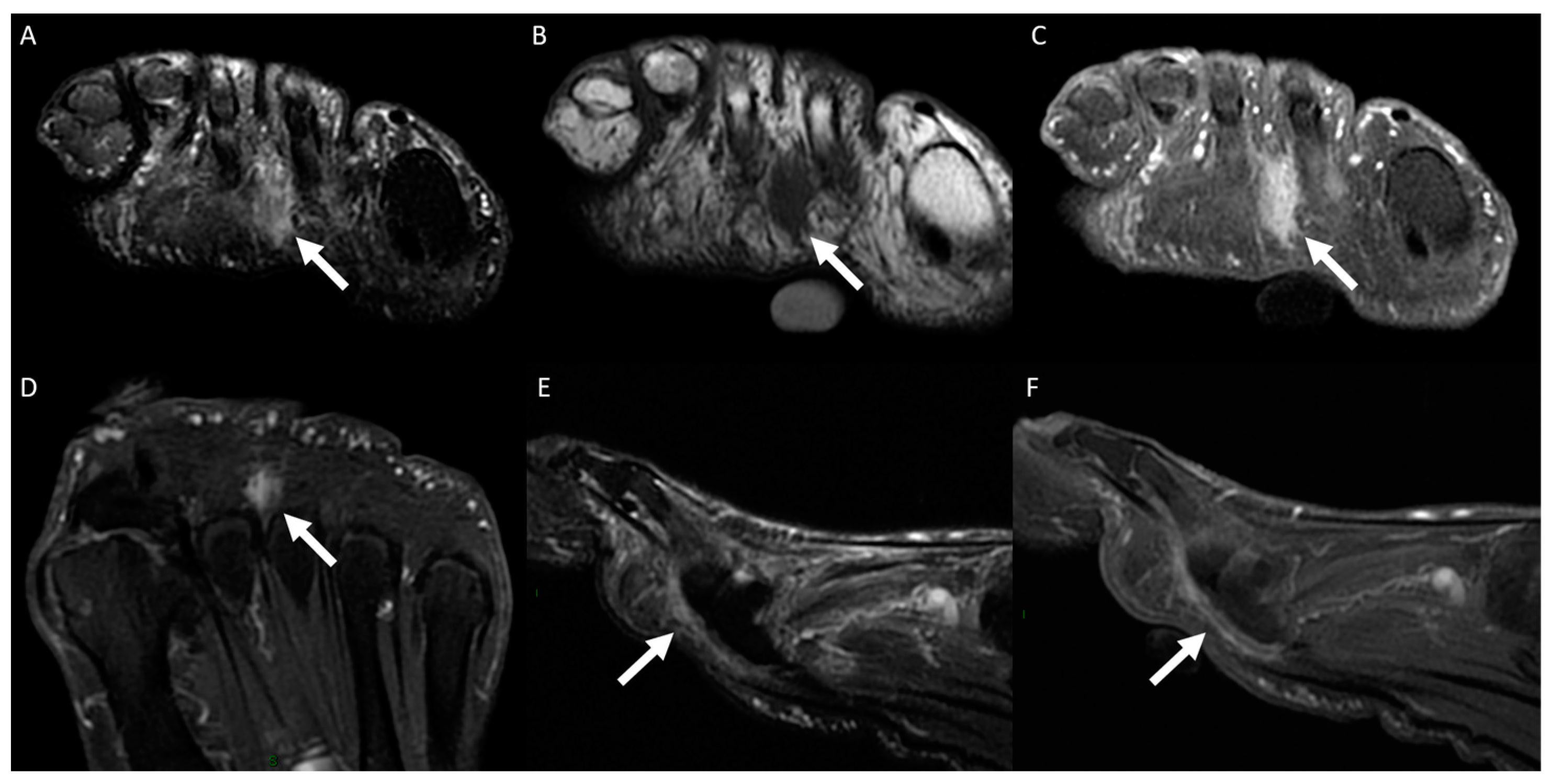 Diagnostics 14 01215 g003