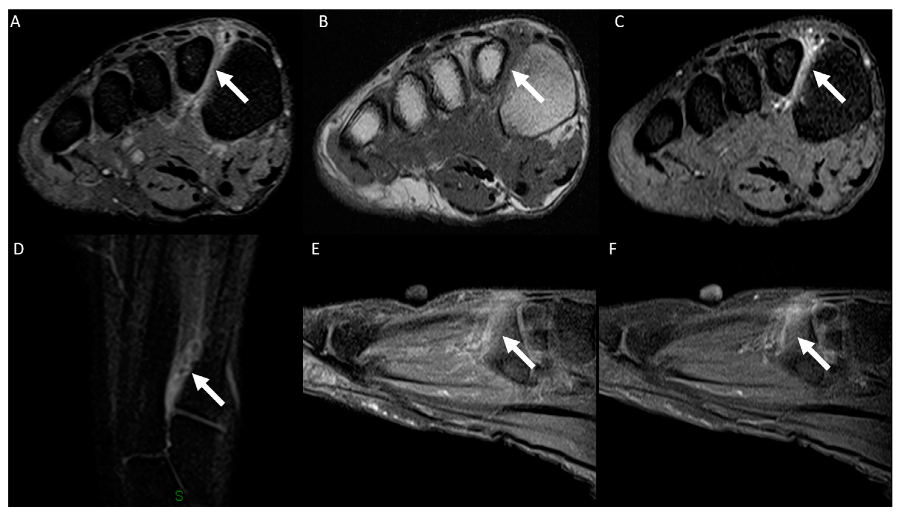 Diagnostics 14 01215 g004