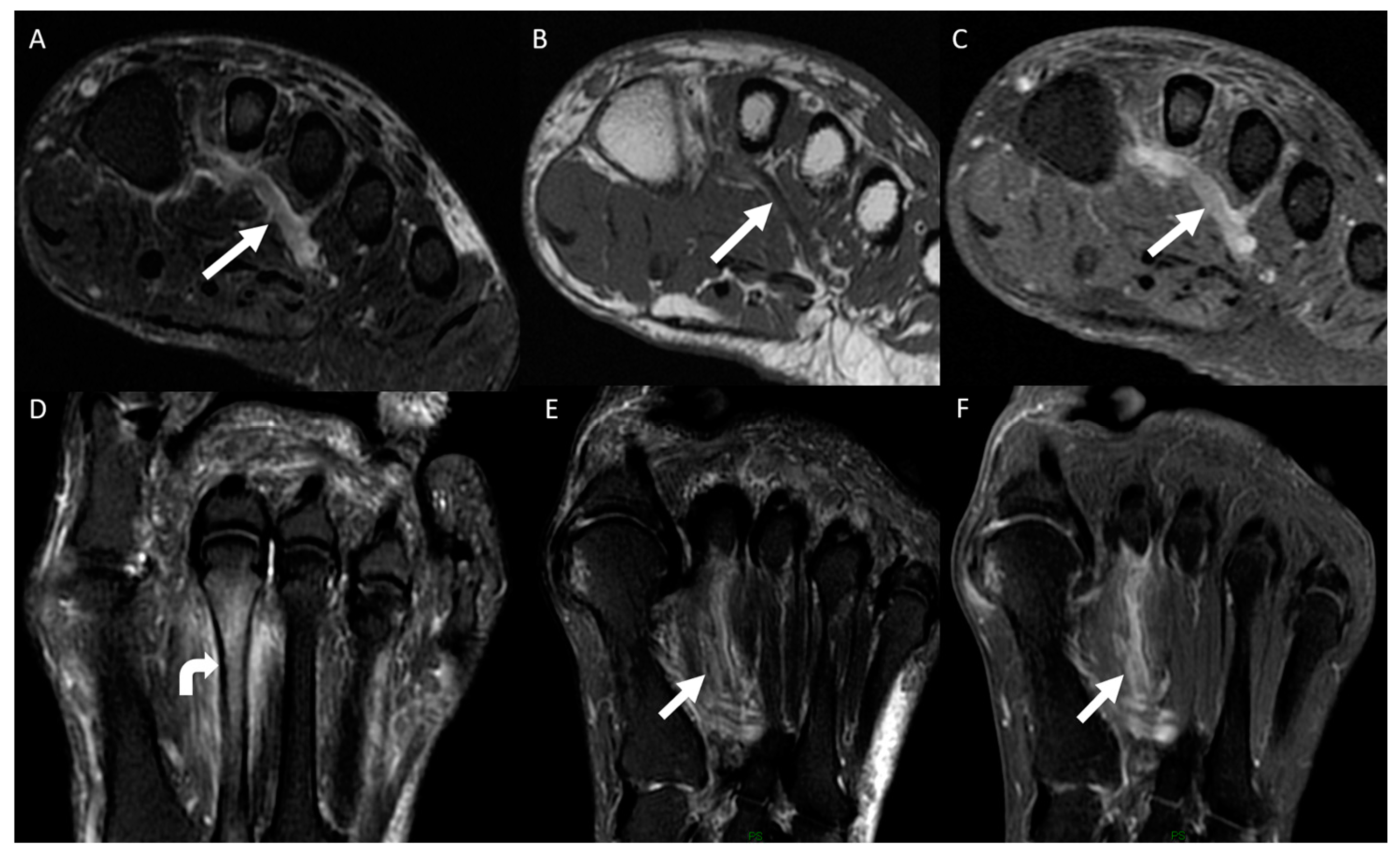 Diagnostics 14 01215 g005