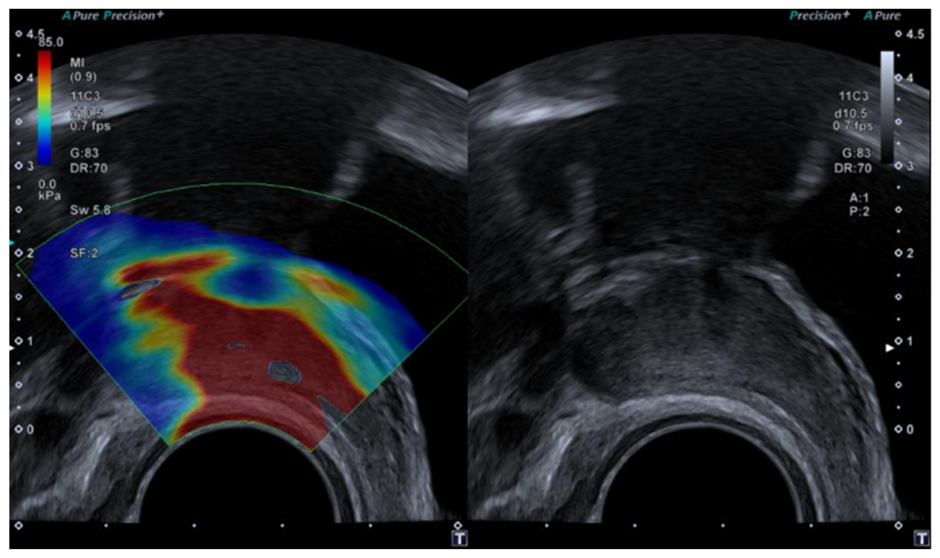 Diagnostics 14 01218 g002 Diagnostics 14 01218 g002