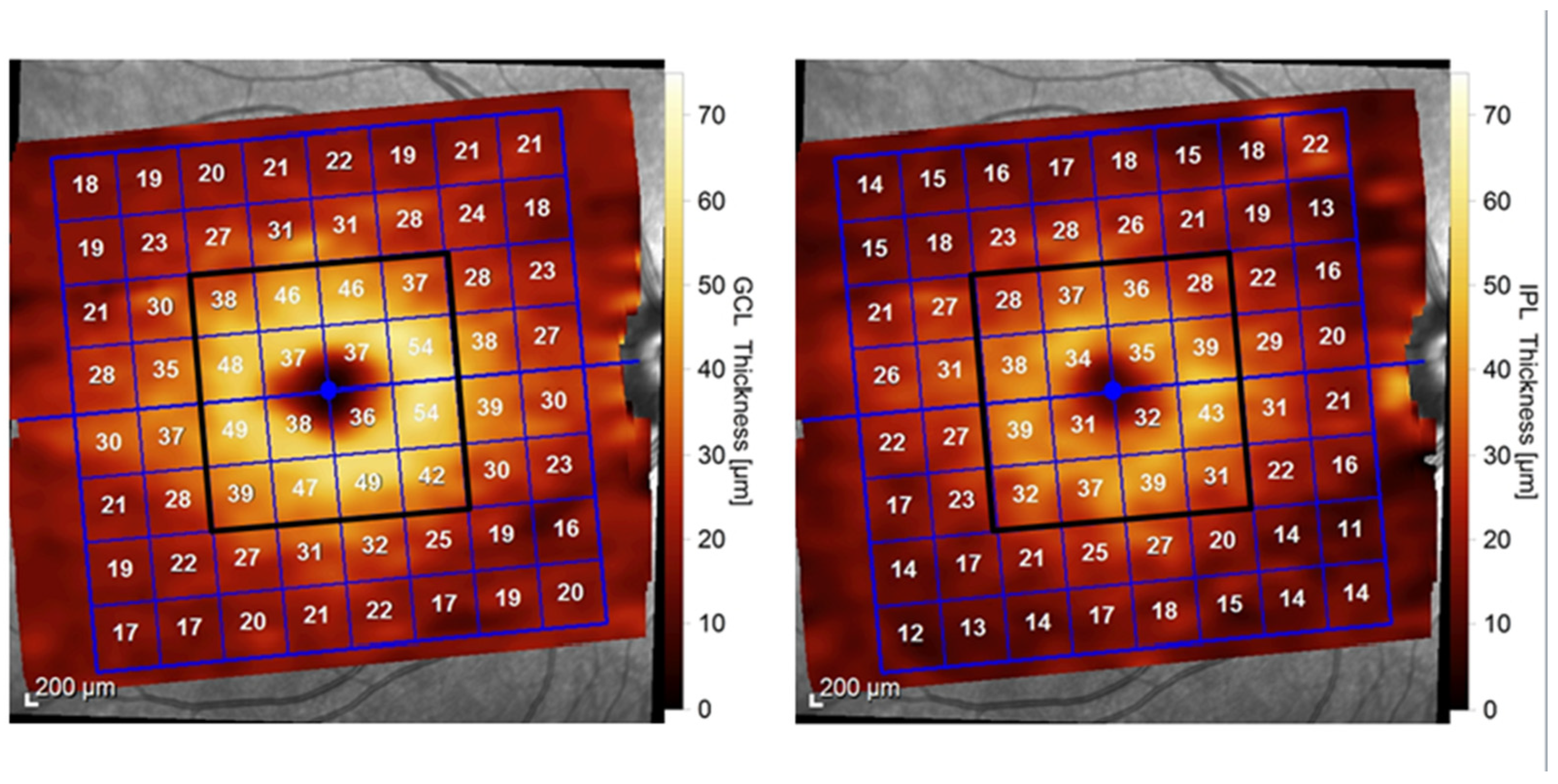 Diagnostics 14 01221 g001
