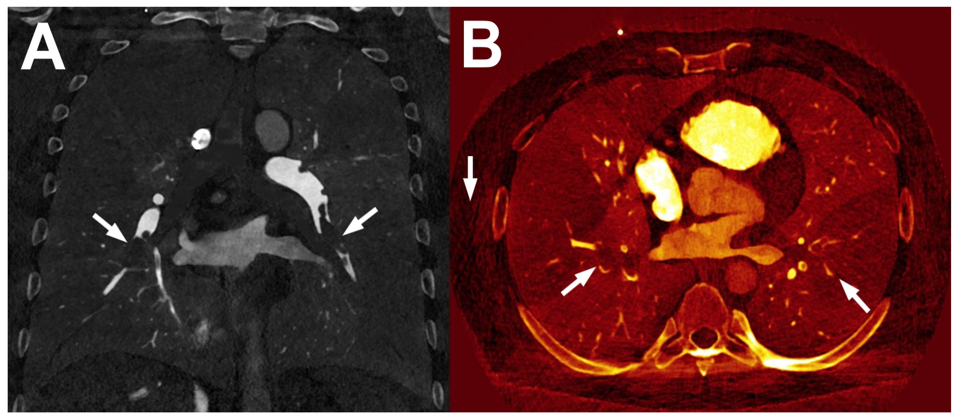 Diagnostics 14 01223 g007