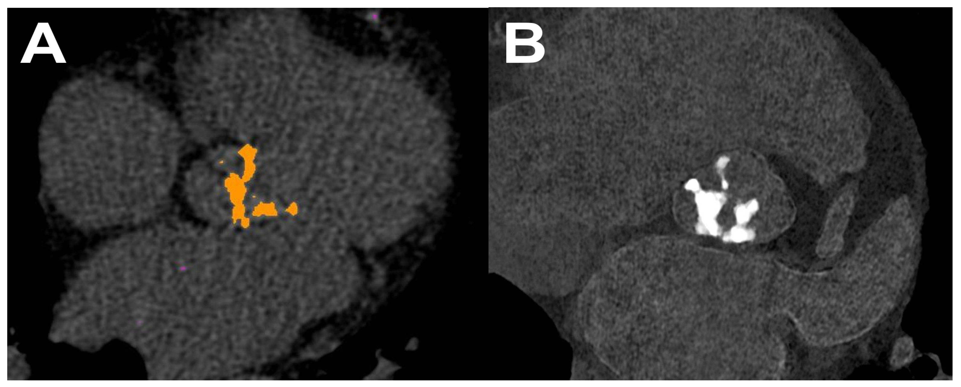 Diagnostics 14 01223 g009