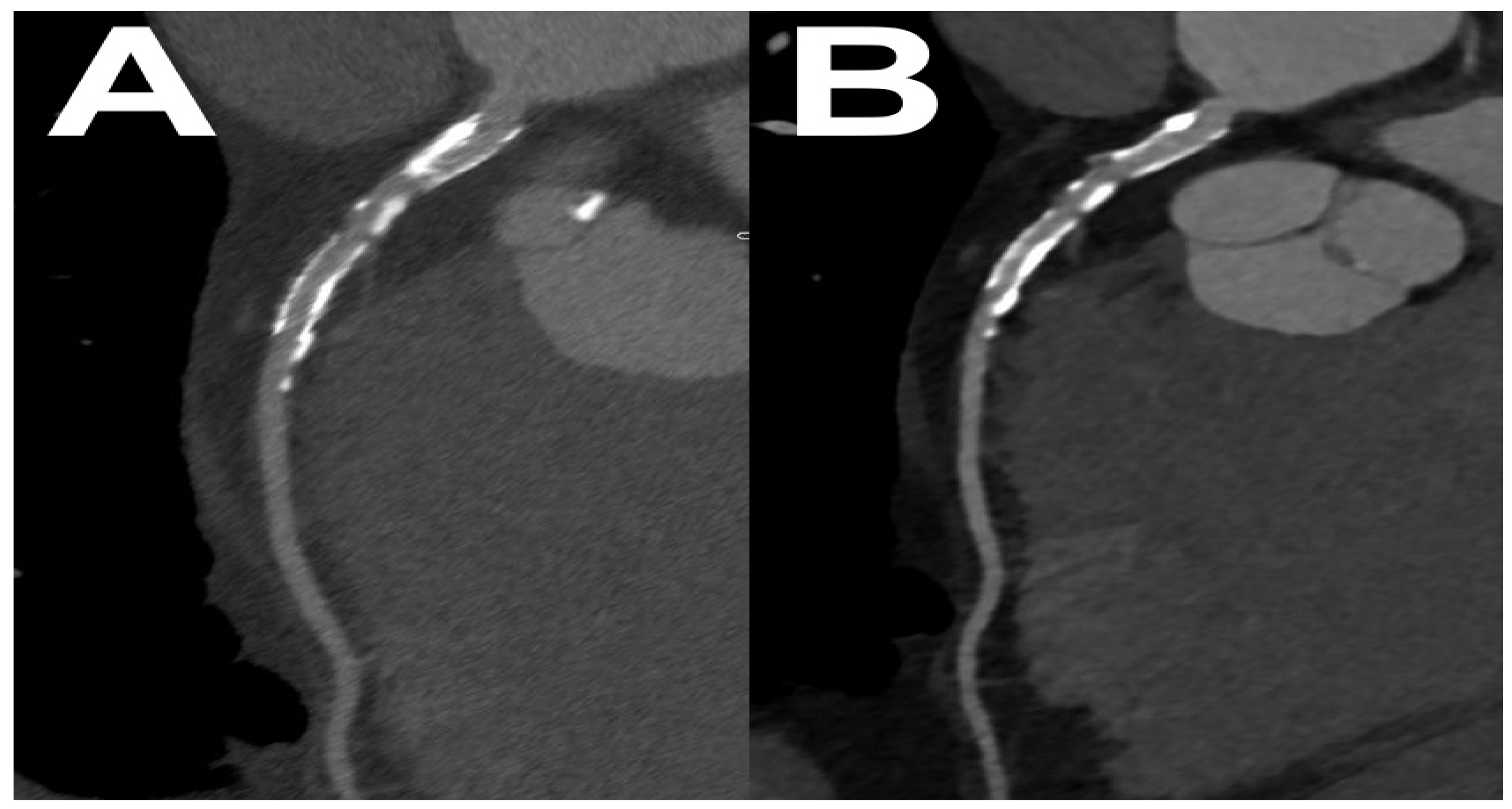 Diagnostics 14 01223 g010