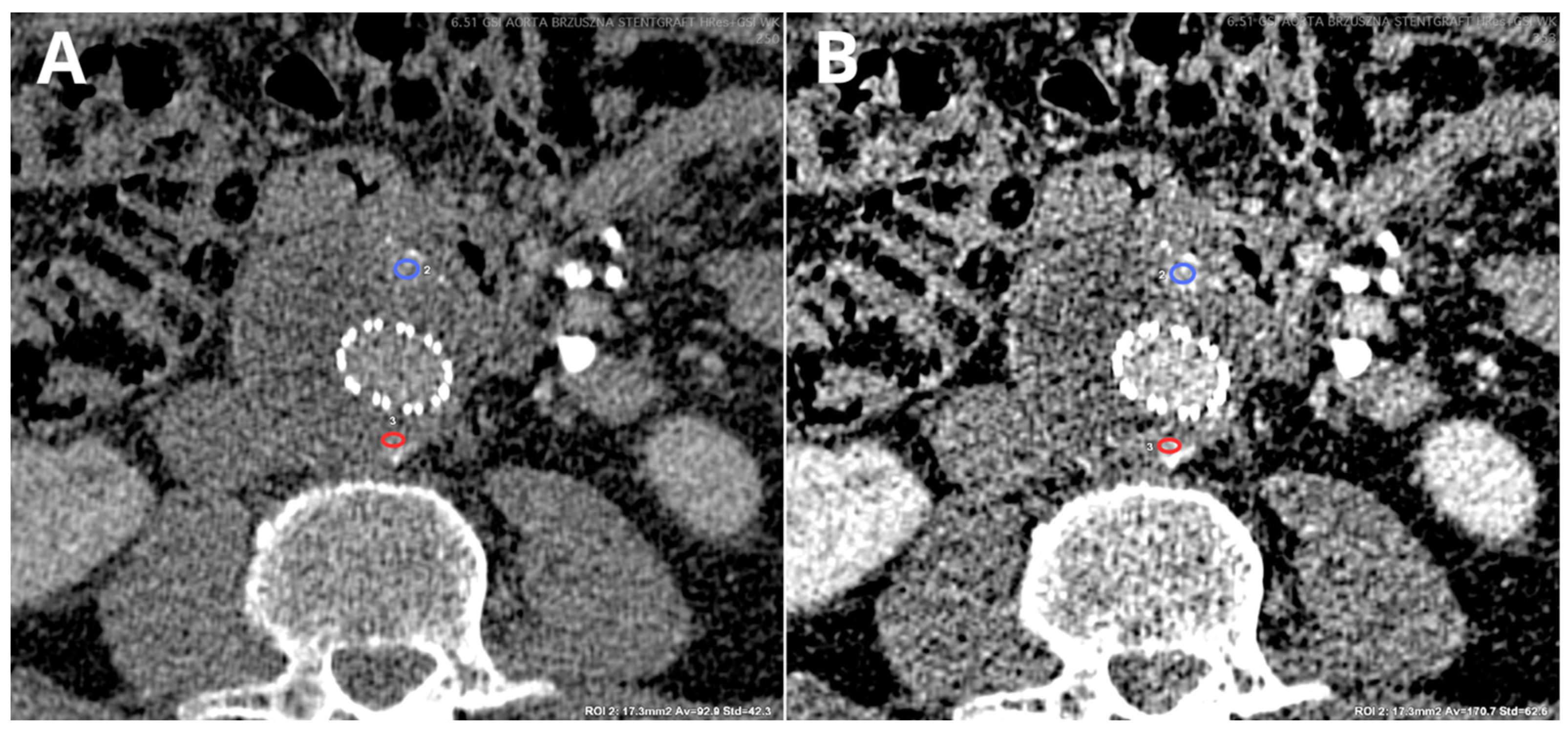 Diagnostics 14 01223 g011