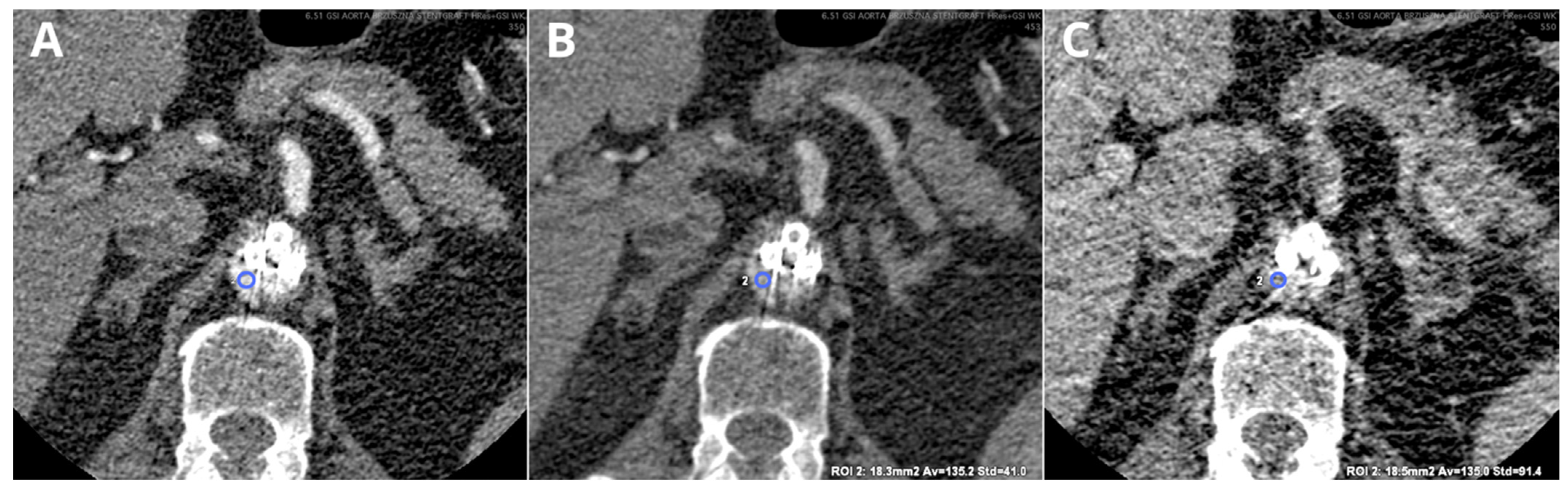 Diagnostics 14 01223 g012