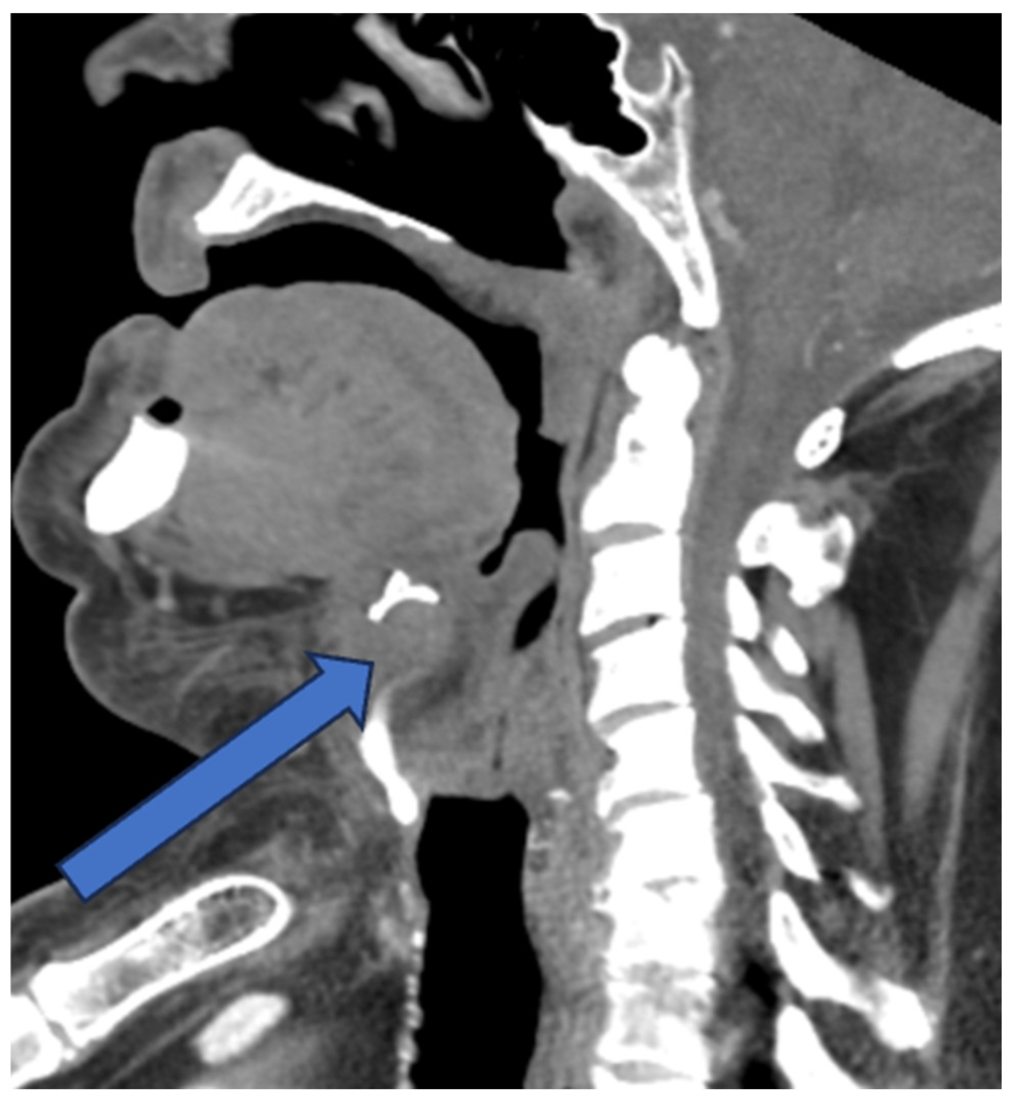 Diagnostics 14 01227 g002