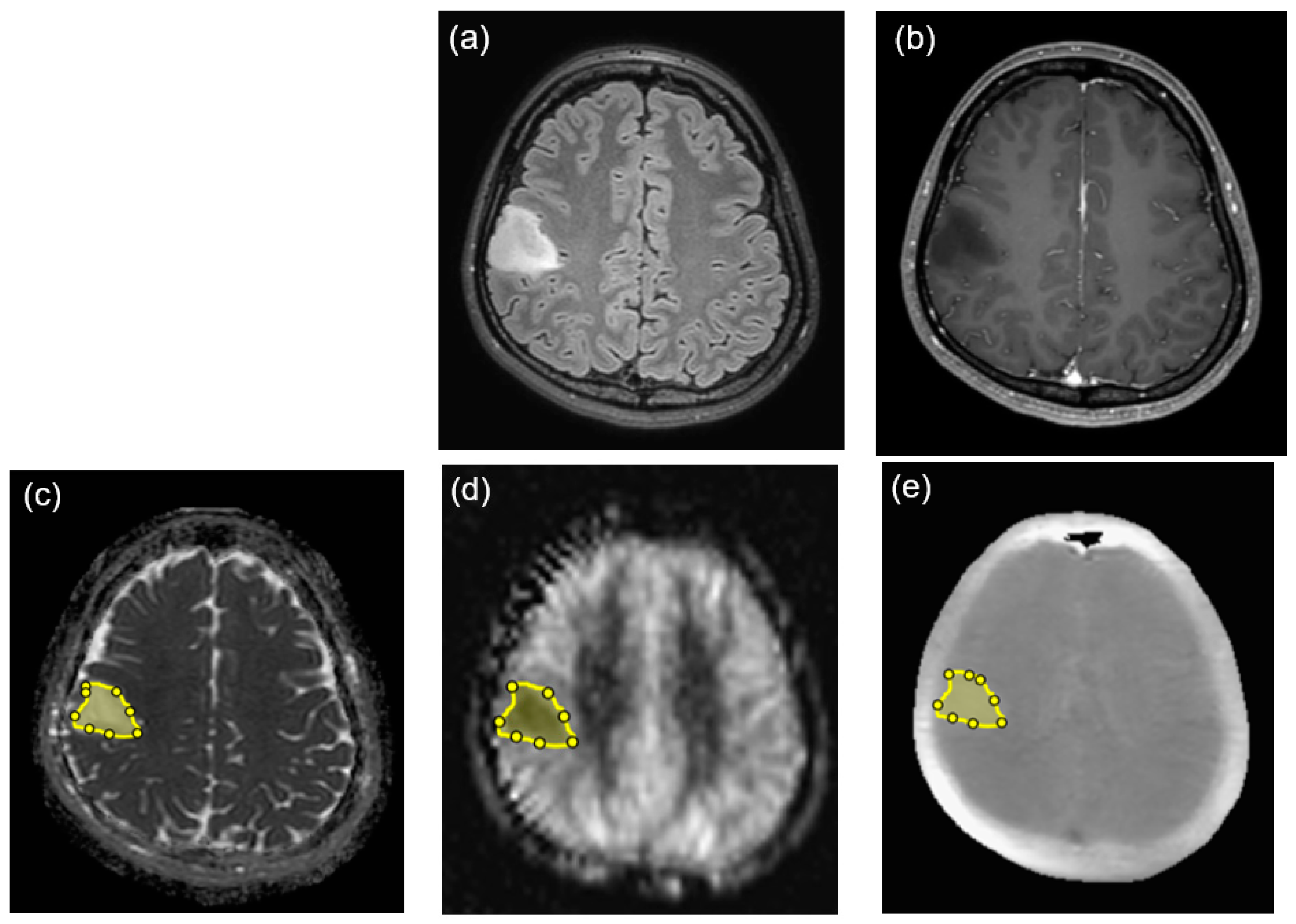 Diagnostics 14 01236 g001