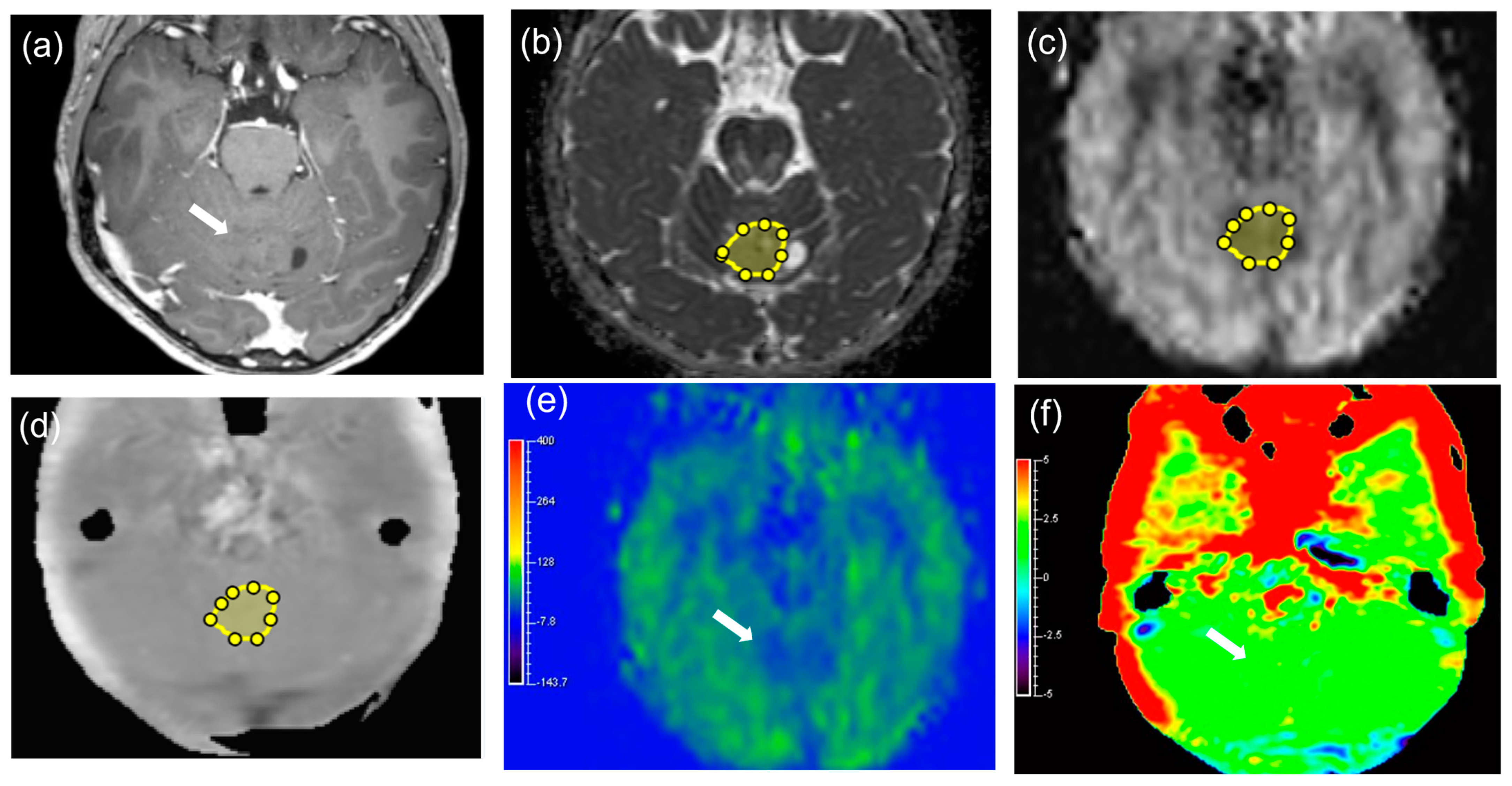 Diagnostics 14 01236 g003a