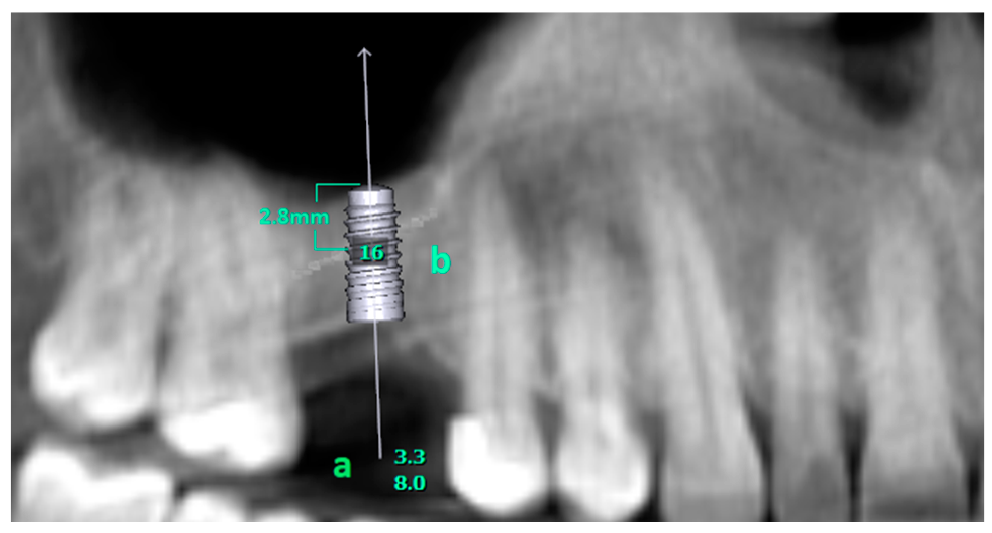 Diagnostics 14 01242 g001