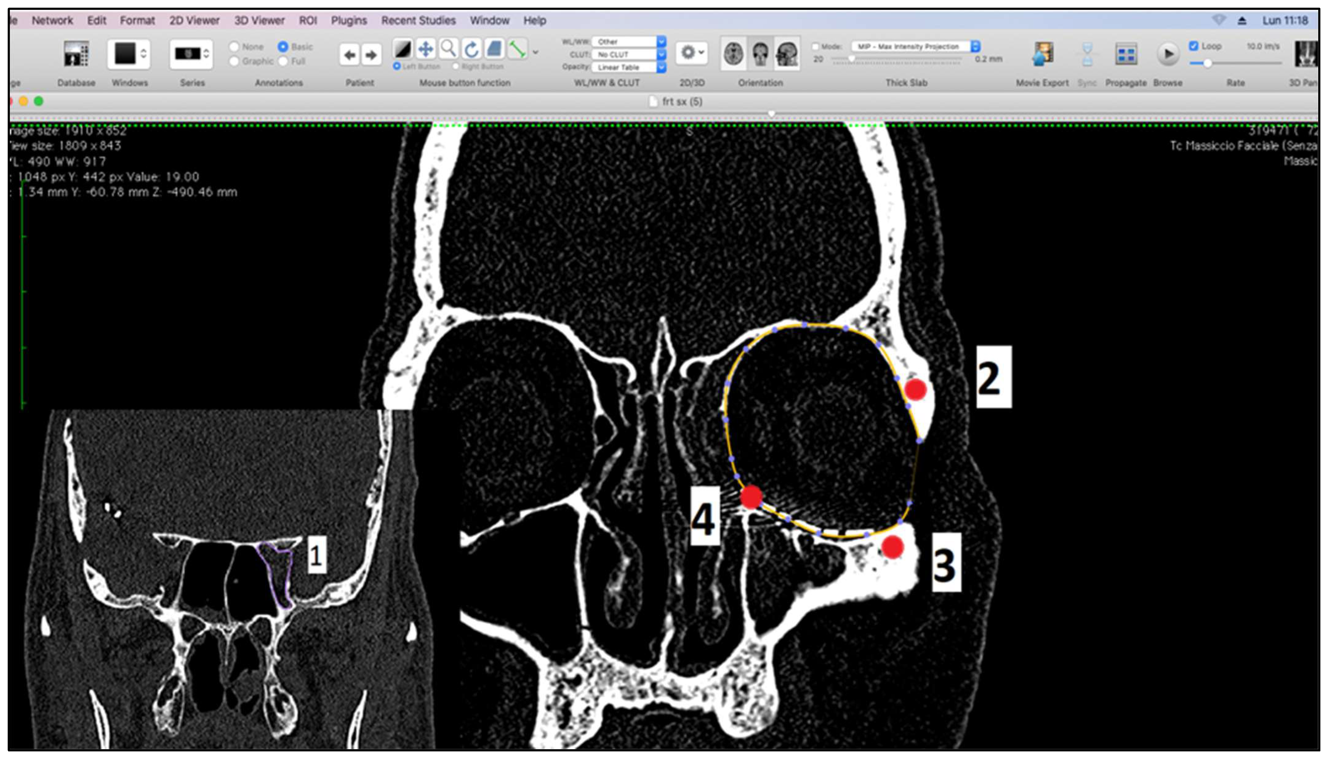Diagnostics 14 01248 g001 Diagnostics 14 01248 g001