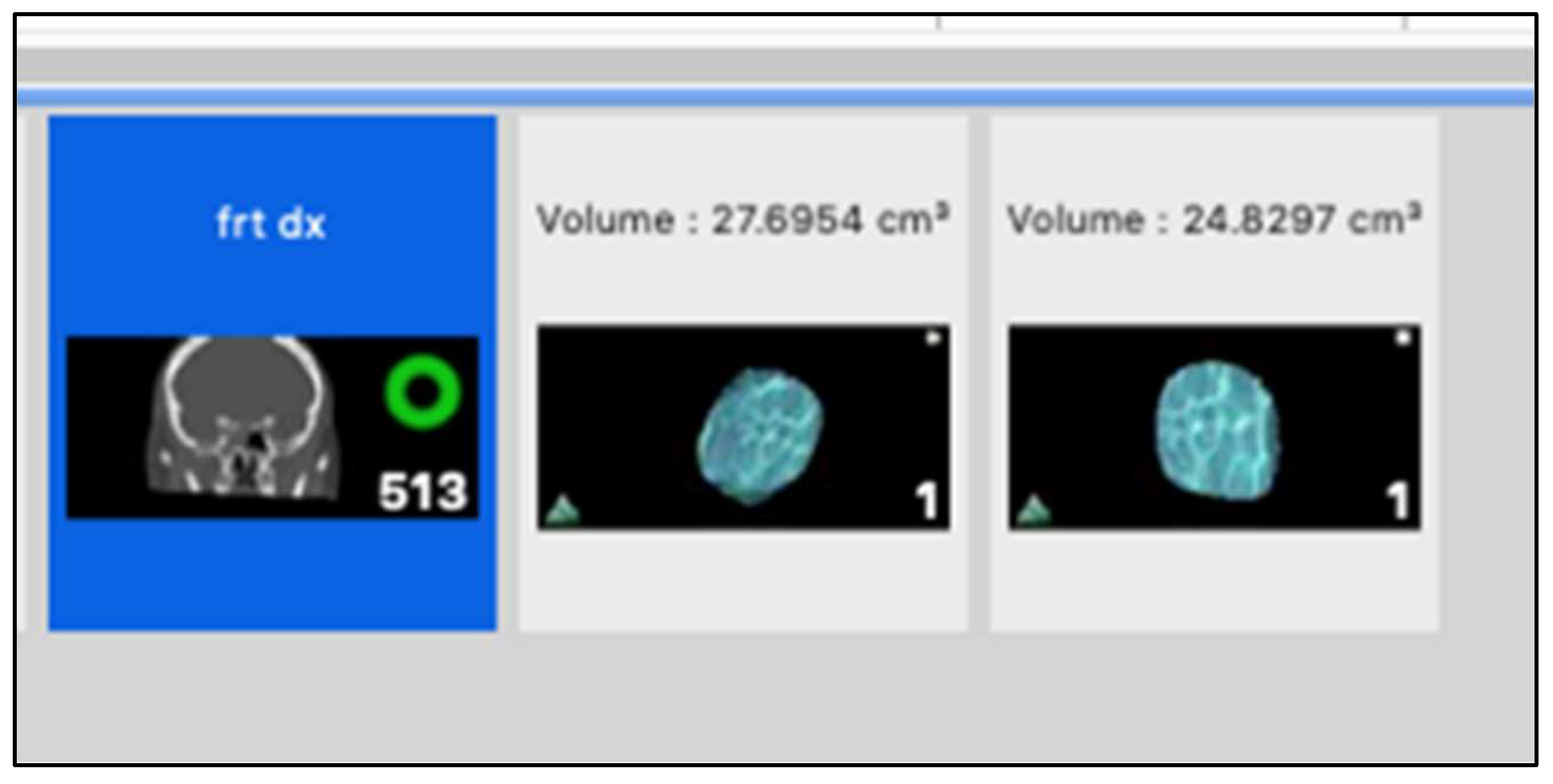 Diagnostics 14 01248 g003 Diagnostics 14 01248 g003