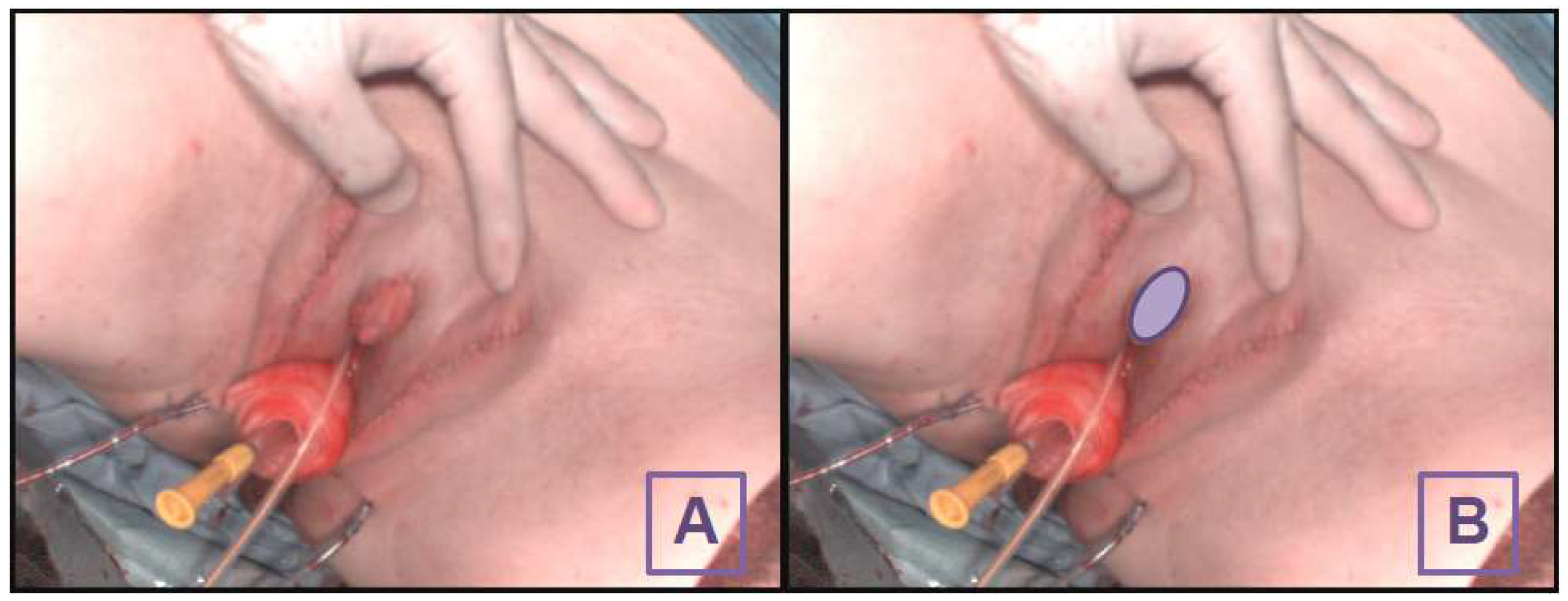 Diagnostics 14 01252 g001